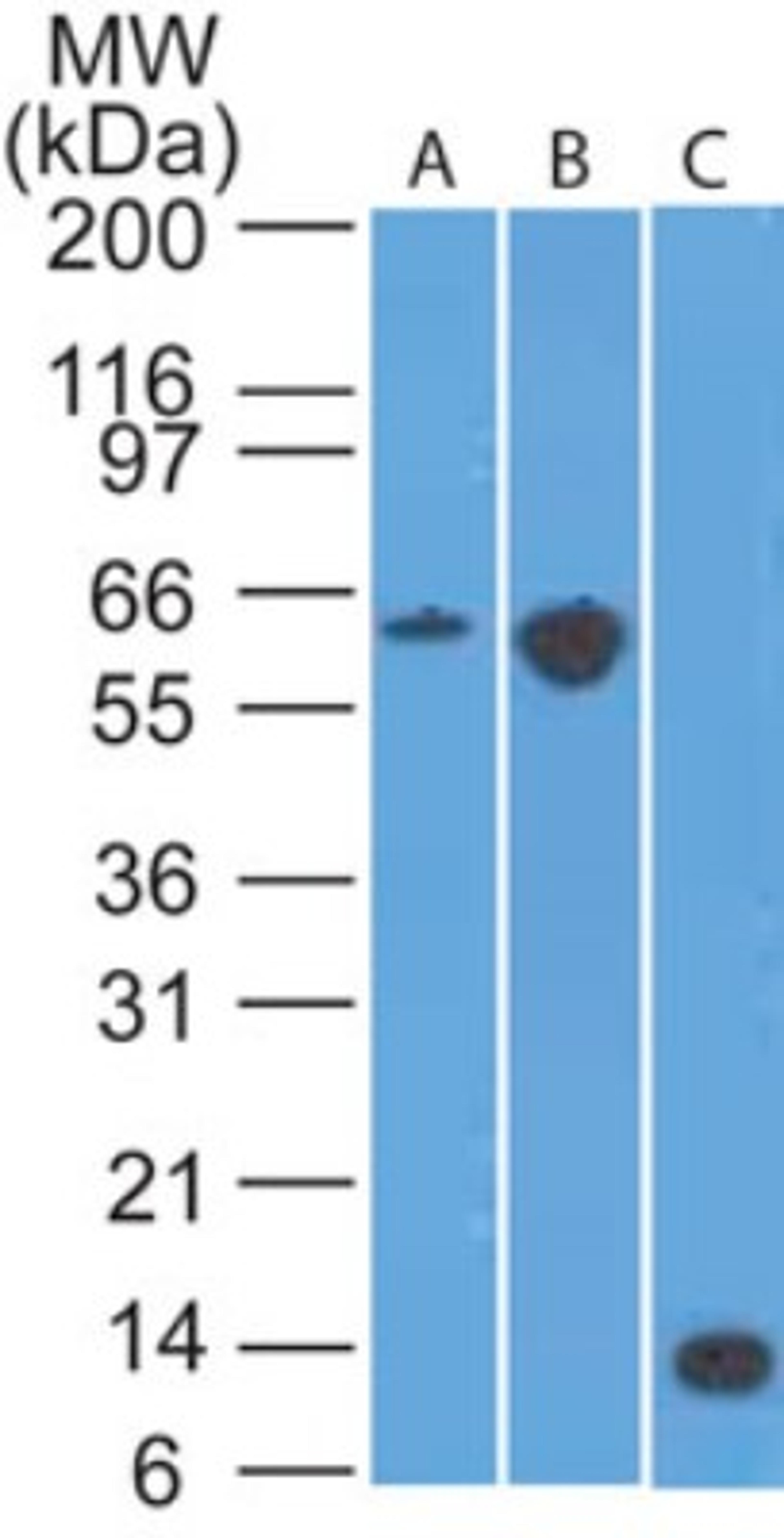 Western Blot: CCR6 Antibody (18B9E6) [NBP2-25220] - analysis of A) mouse EL4, B) conA treated EL4 lysate and C) partial recombinant protein using CD196 (CCR6) antibody at 2 ug/ml.