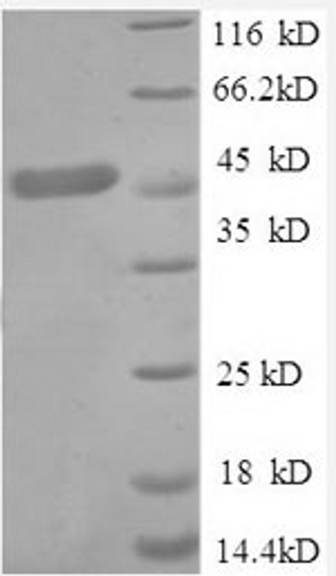 (Tris-Glycine gel) Discontinuous SDS-PAGE (reduced) with 5% enrichment gel and 15% separation gel.