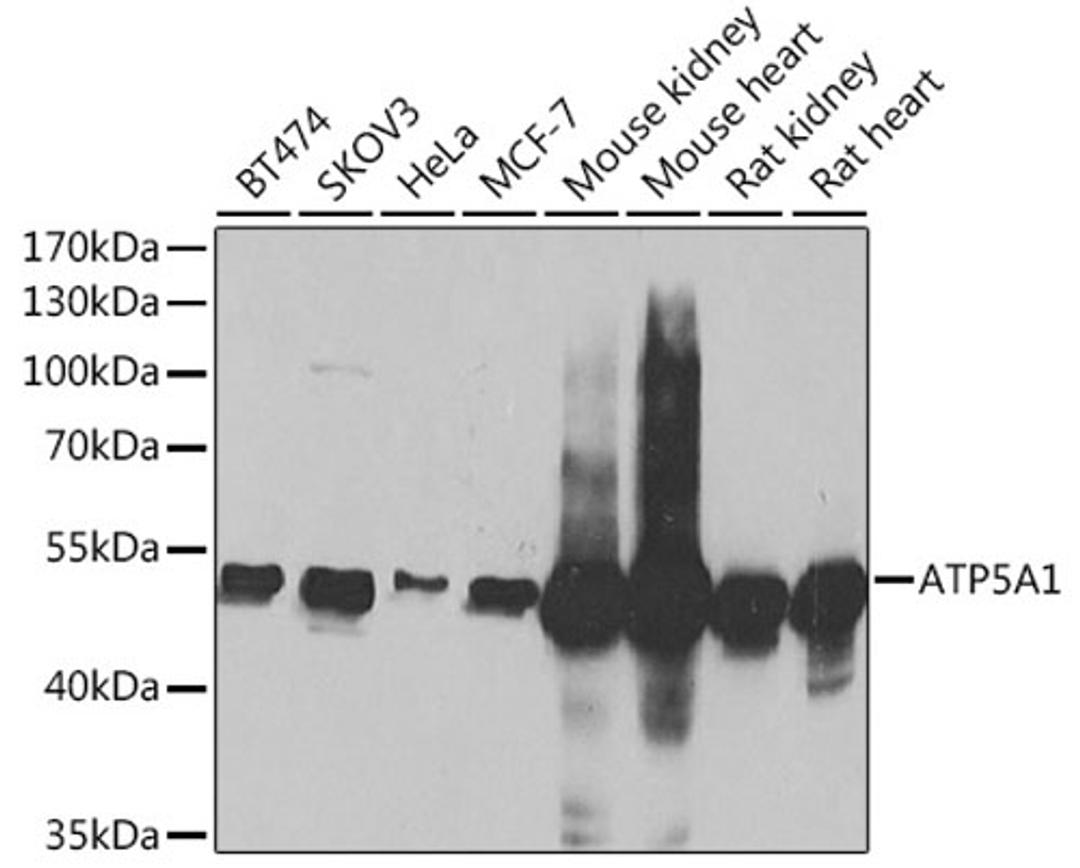 Western blot - ATP5A1 Antibody (A5884)