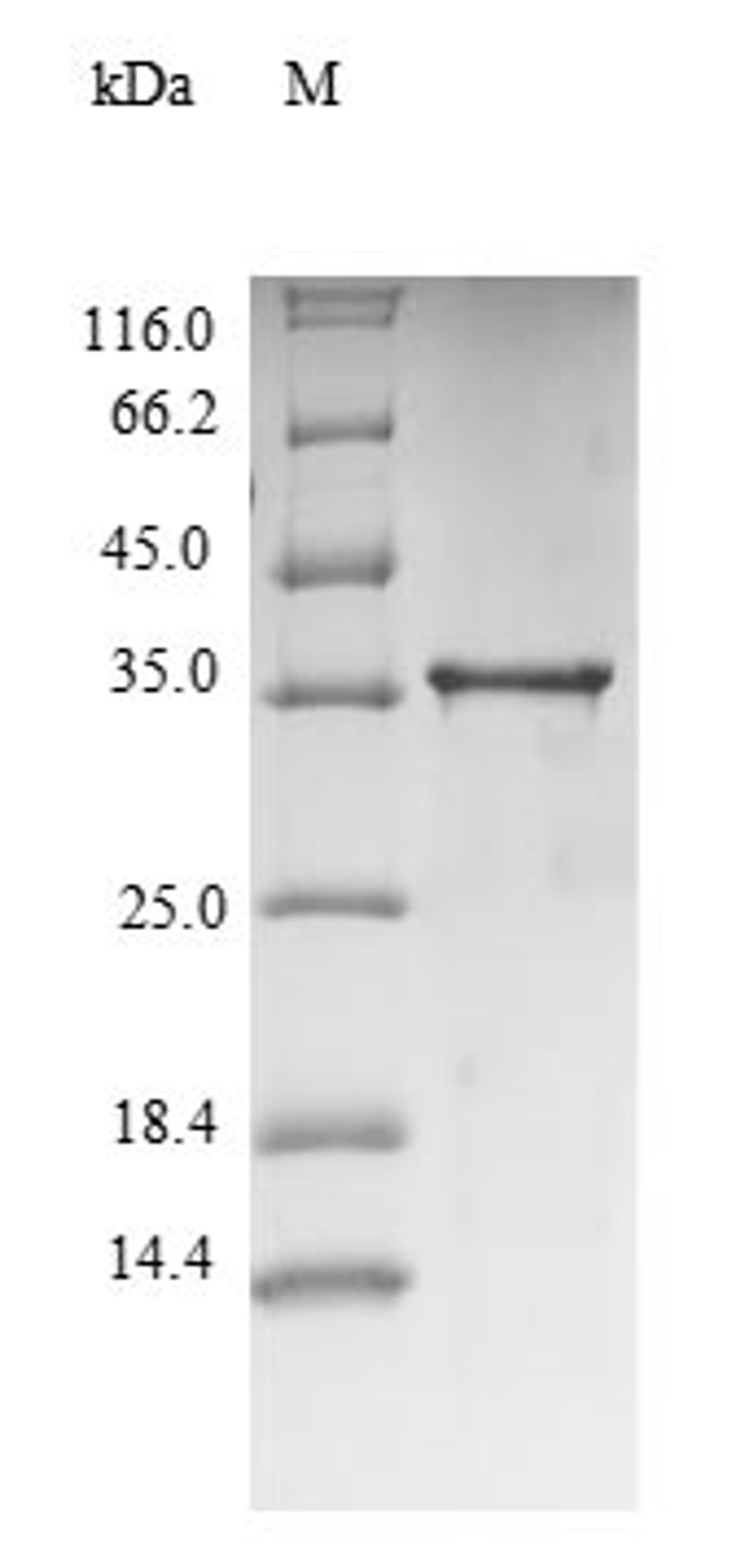 (Tris-Glycine gel) Discontinuous SDS-PAGE (reduced) with 5% enrichment gel and 15% separation gel.