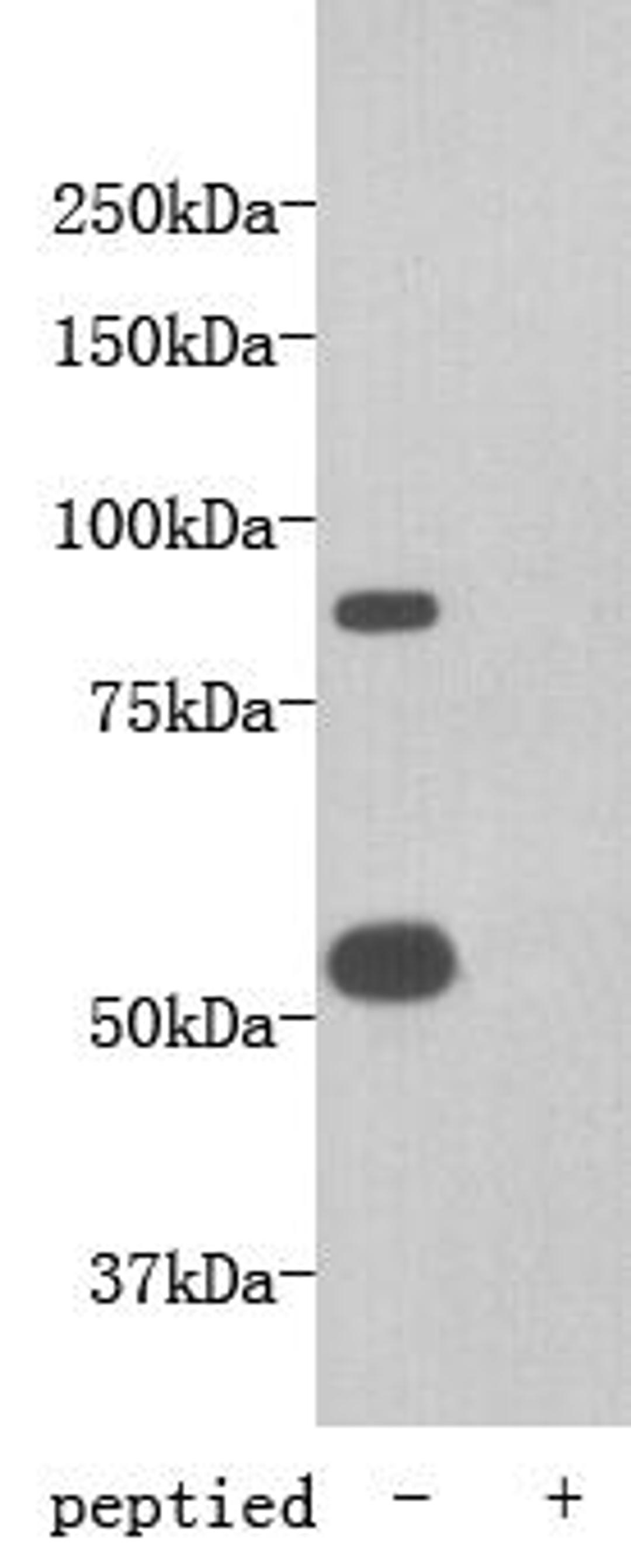 Western Blot analysis of mouse heart using Transmembrane protein 2 antibody