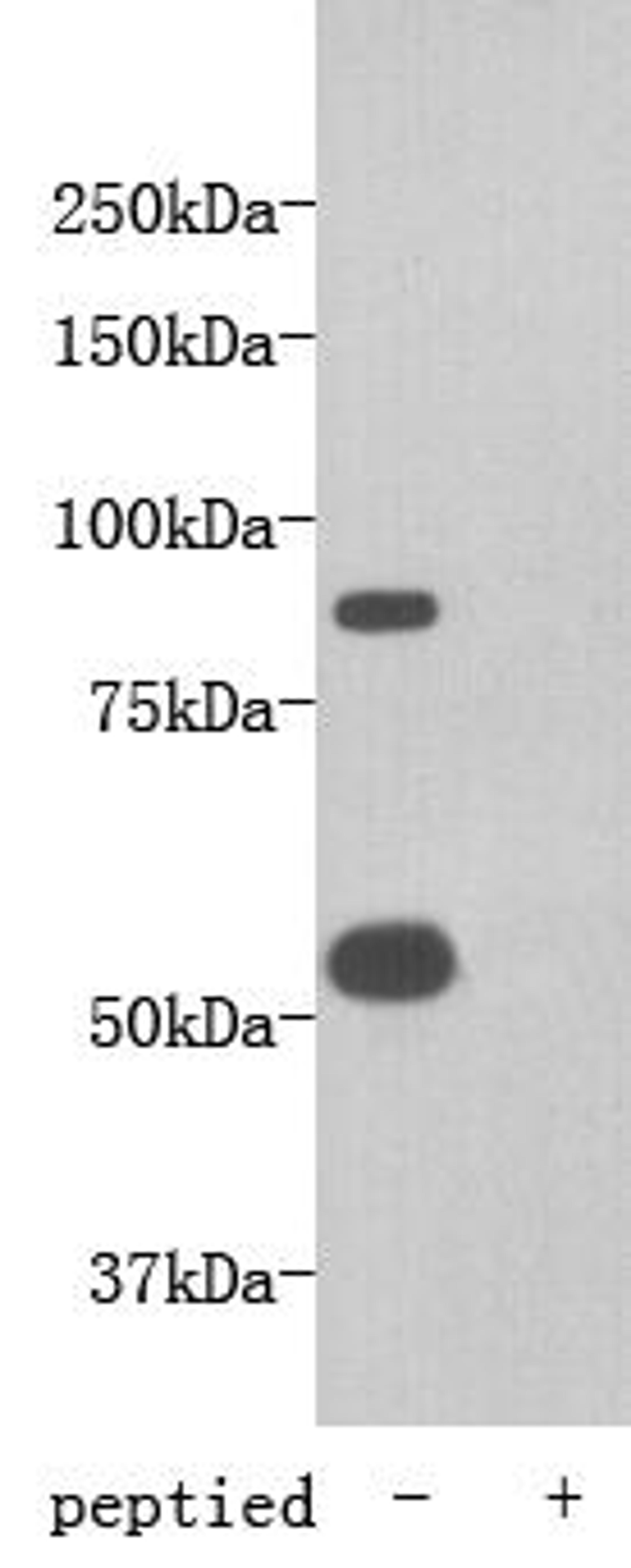 Western Blot analysis of mouse heart using Transmembrane protein 2 antibody