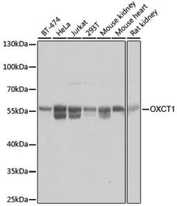 Western blot - OXCT1 antibody (A8139)