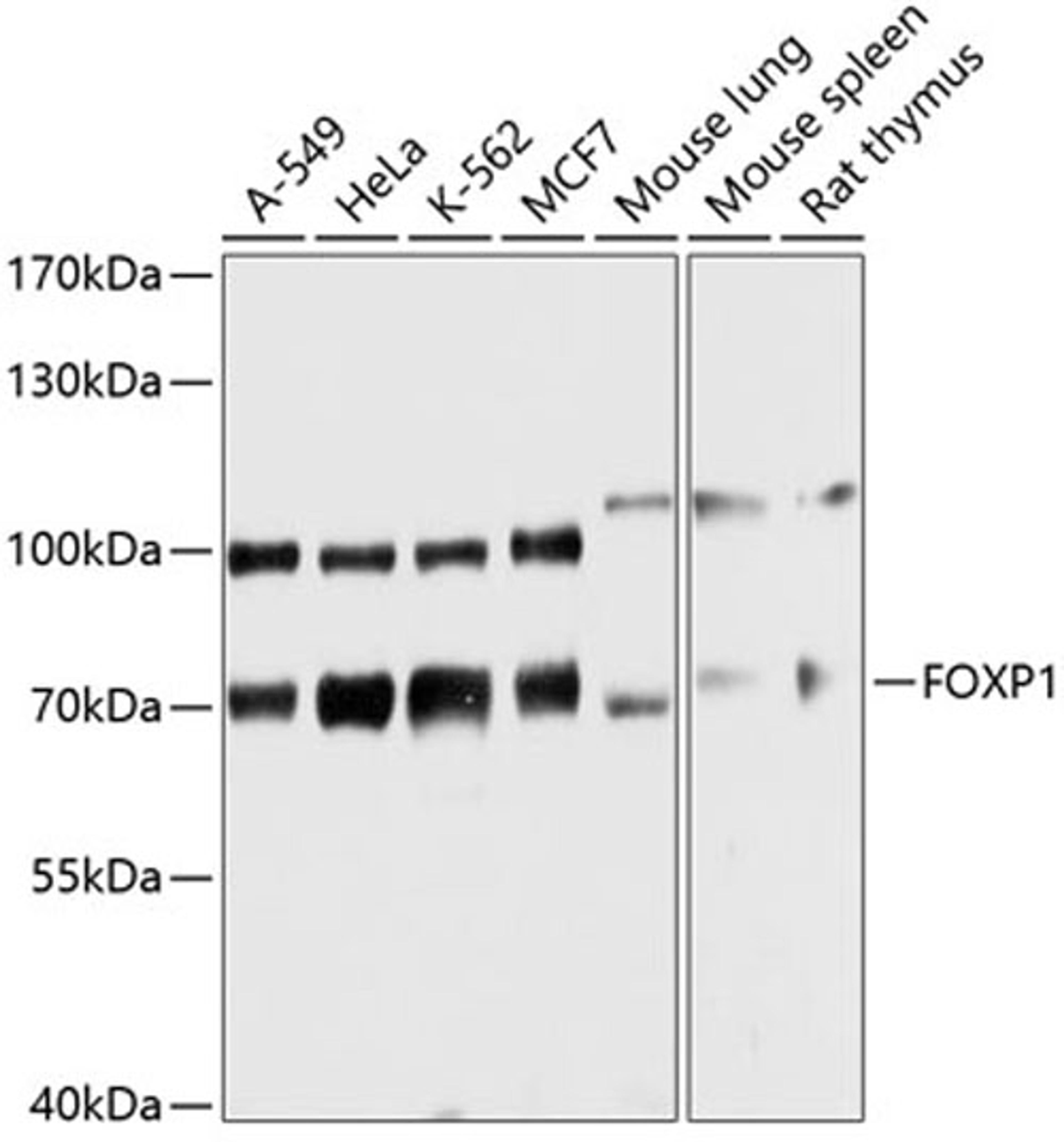 Western blot - FOXP1 antibody (A12685)