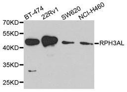 Western blot analysis of extract of various cells using RPH3AL antibody