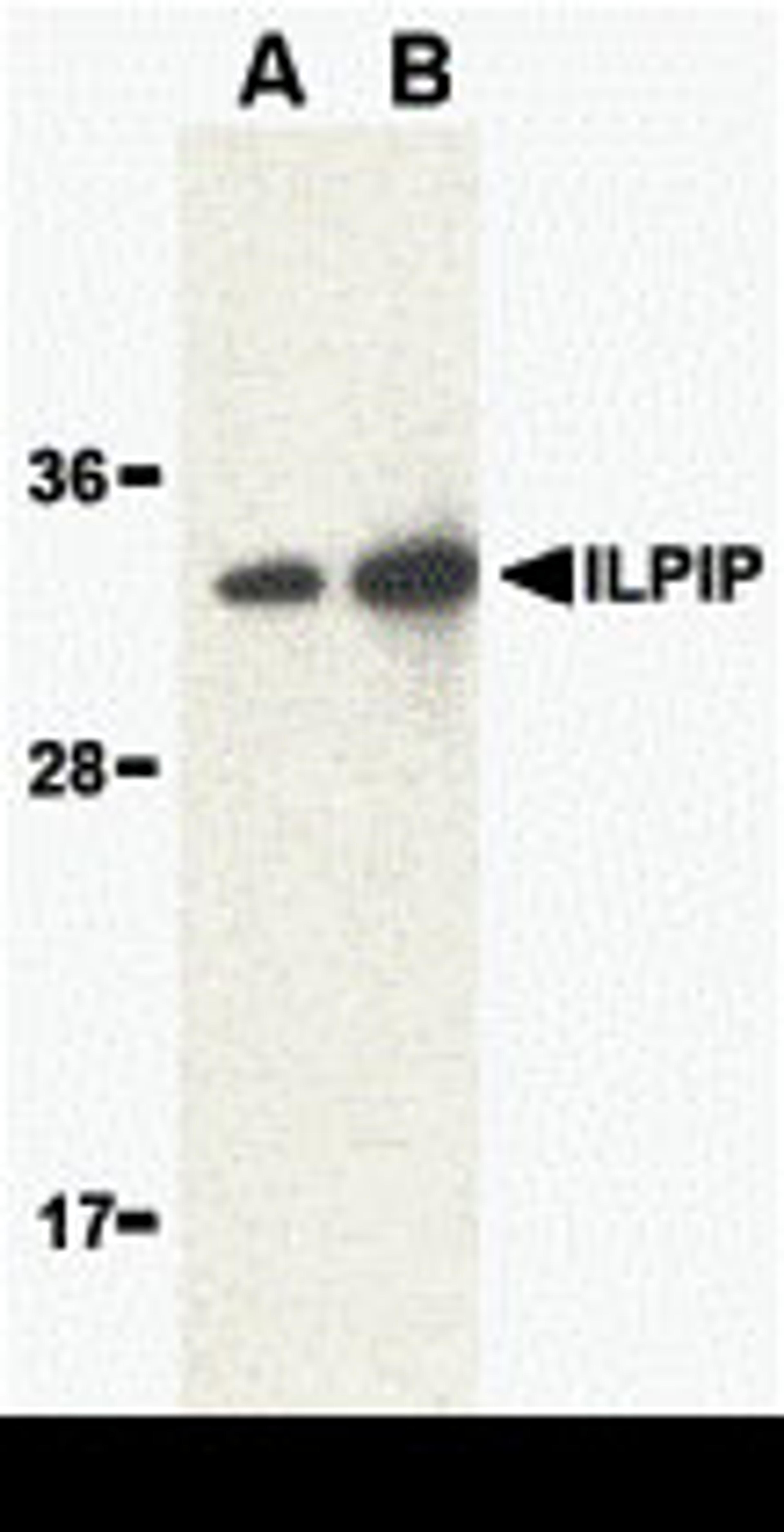 Western blot analysis of ILPIP in human brain lysate with ILPIP antibody at (A) 1 and (B) 2 &#956;g/mL. 