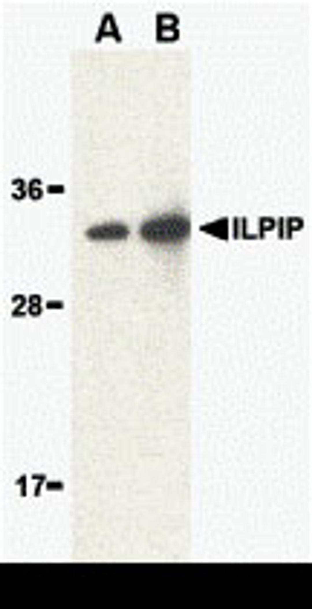 Western blot analysis of ILPIP in human brain lysate with ILPIP antibody at (A) 1 and (B) 2 μg/mL.