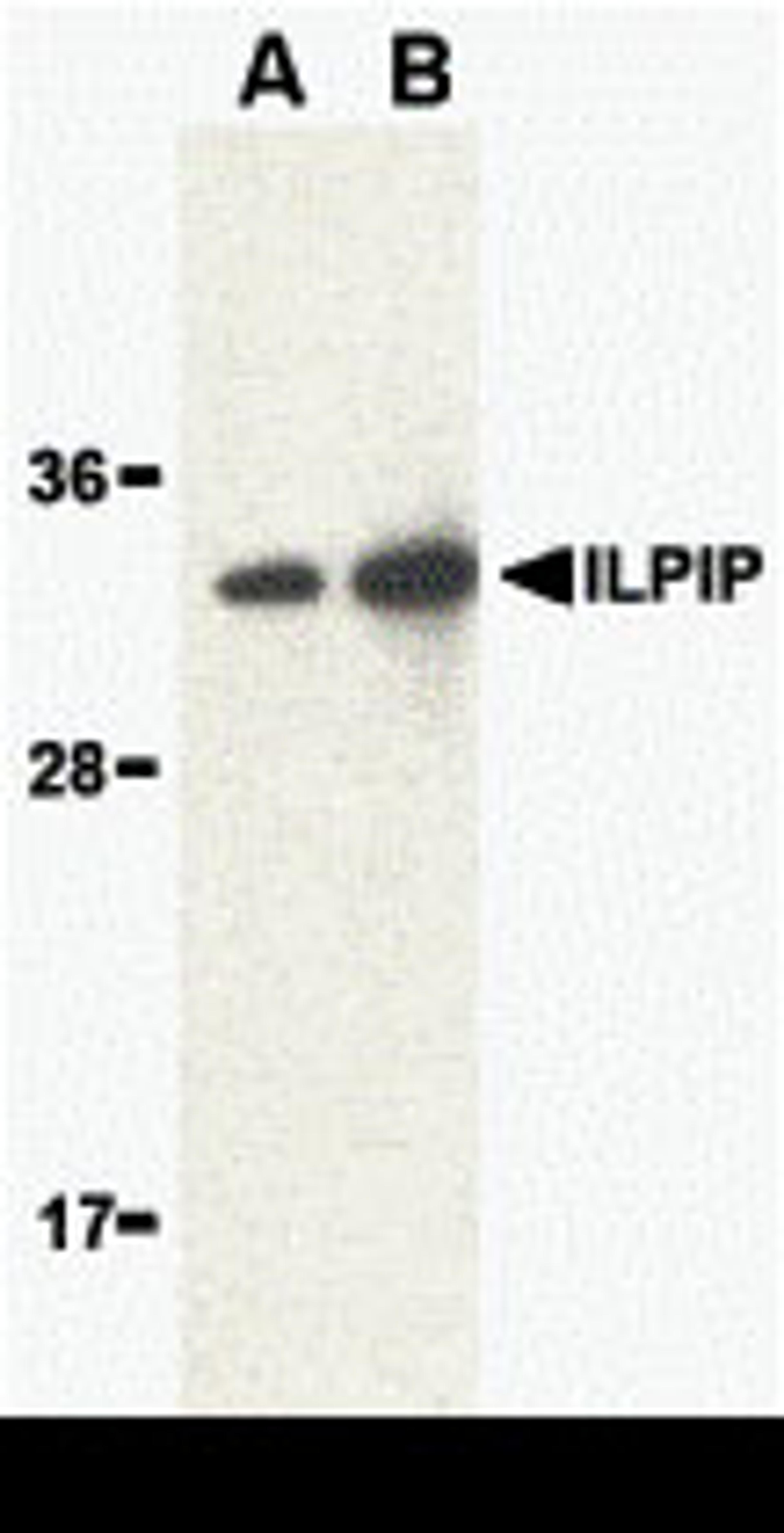 Western blot analysis of ILPIP in human brain lysate with ILPIP antibody at (A) 1 and (B) 2 μg/mL.