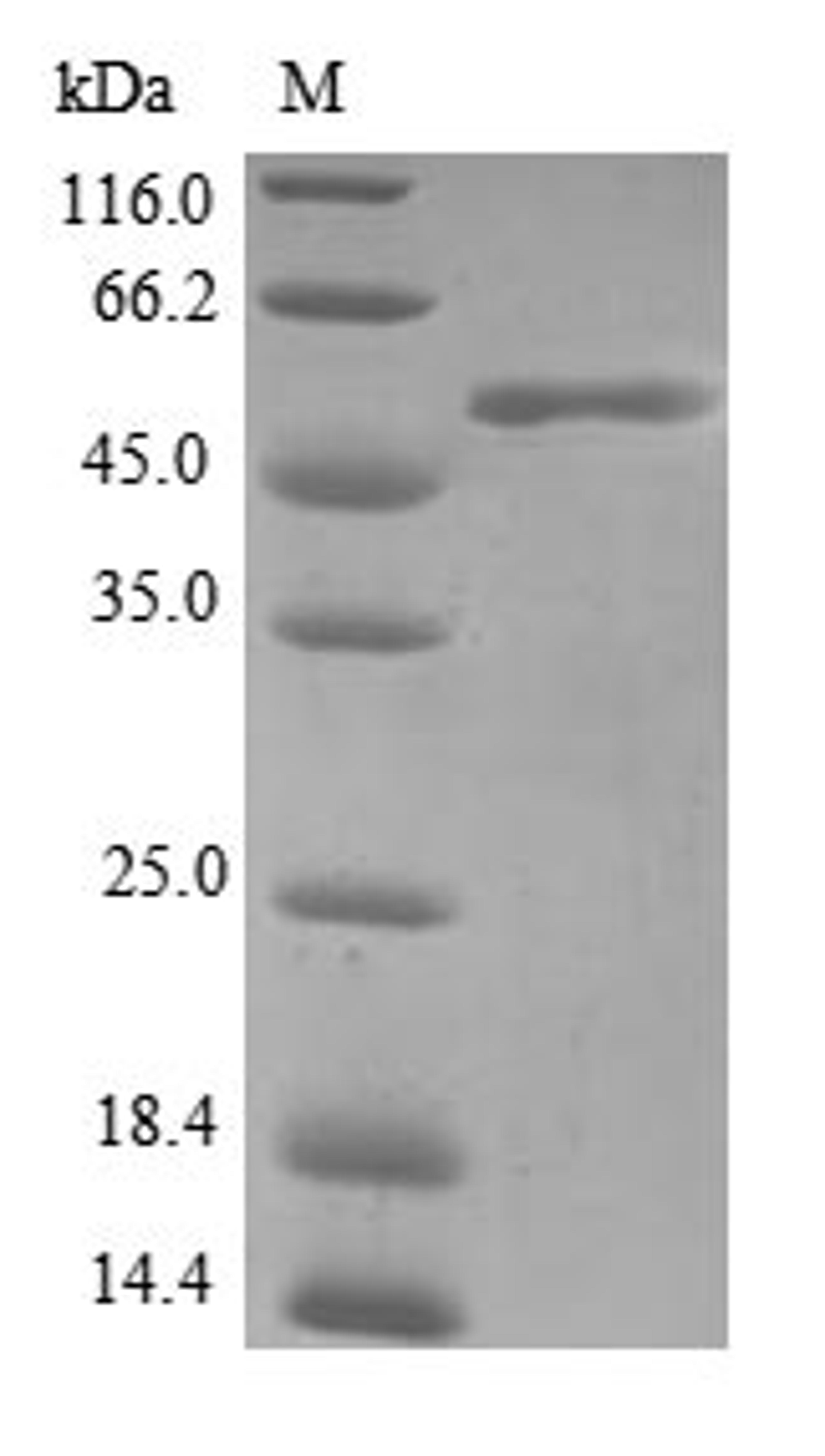 (Tris-Glycine gel) Discontinuous SDS-PAGE (reduced) with 5% enrichment gel and 15% separation gel.