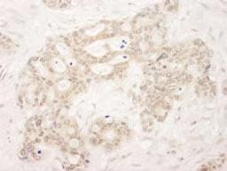 Detection of human QSER1 immunohistochemistry.