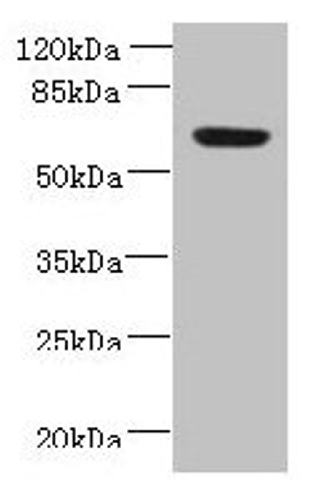 Western blot. All lanes: NXPE1 antibody at 4µg/ml + Human high value serum. Secondary. Goat polyclonal to rabbit IgG at 1/10000 dilution. Predicted band size: 64, 47 kDa. Observed band size: 64 kDa
