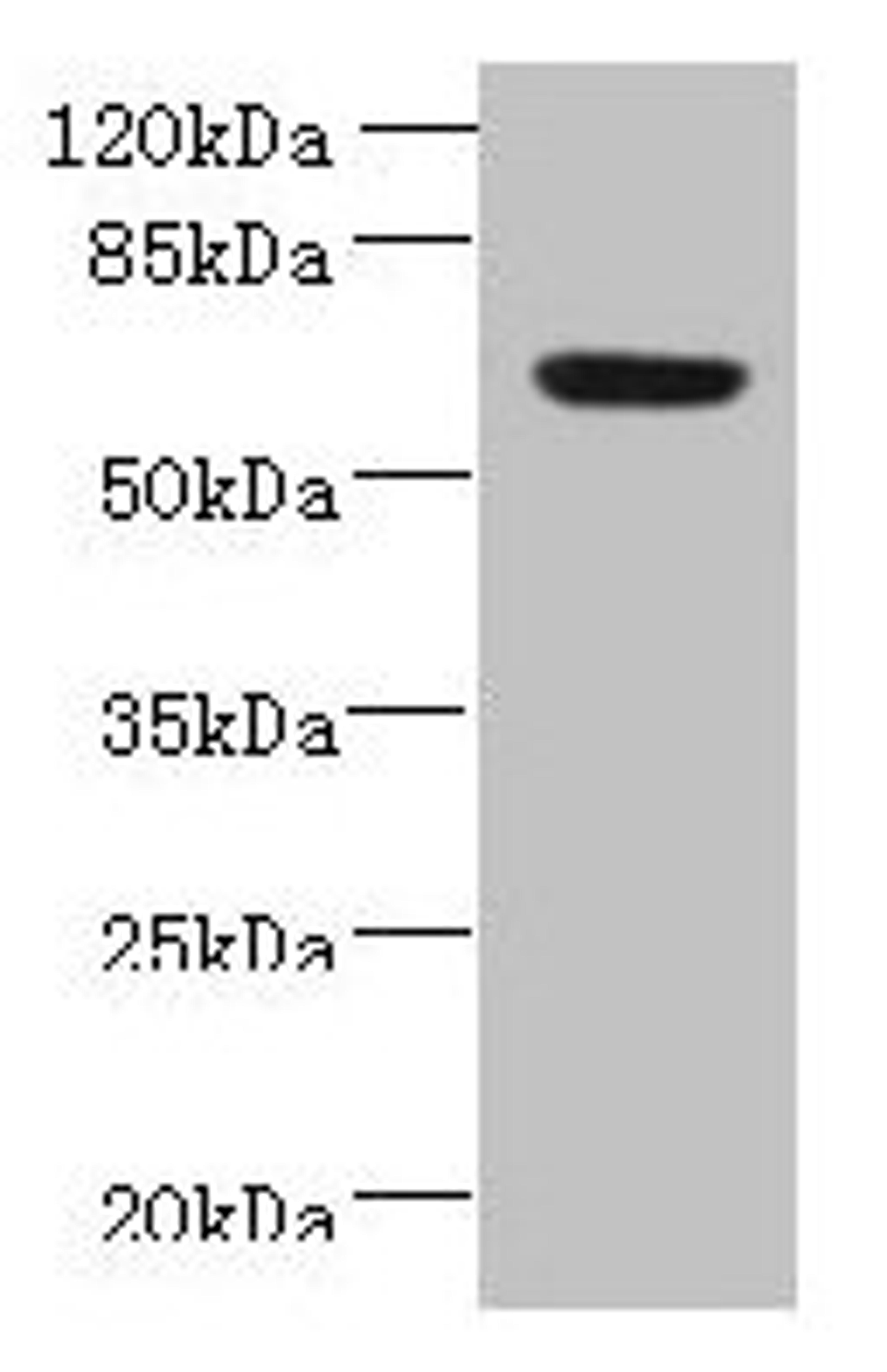 Western blot. All lanes: NXPE1 antibody at 4µg/ml + Human high value serum. Secondary. Goat polyclonal to rabbit IgG at 1/10000 dilution. Predicted band size: 64, 47 kDa. Observed band size: 64 kDa