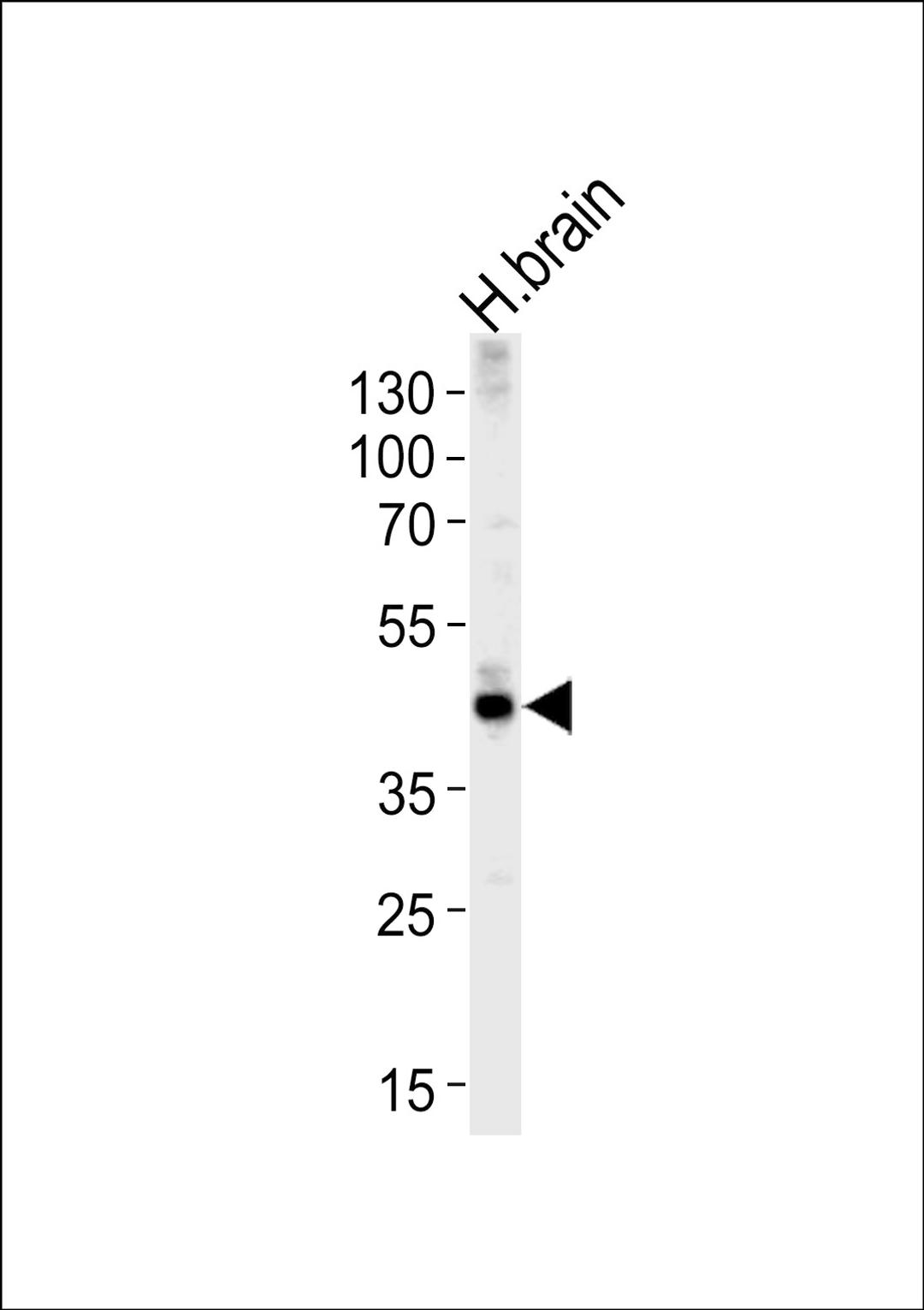 Western blot analysis of lysate from human brain tissue lysate, using ALDOC Antibody at 1:1000 at each lane.