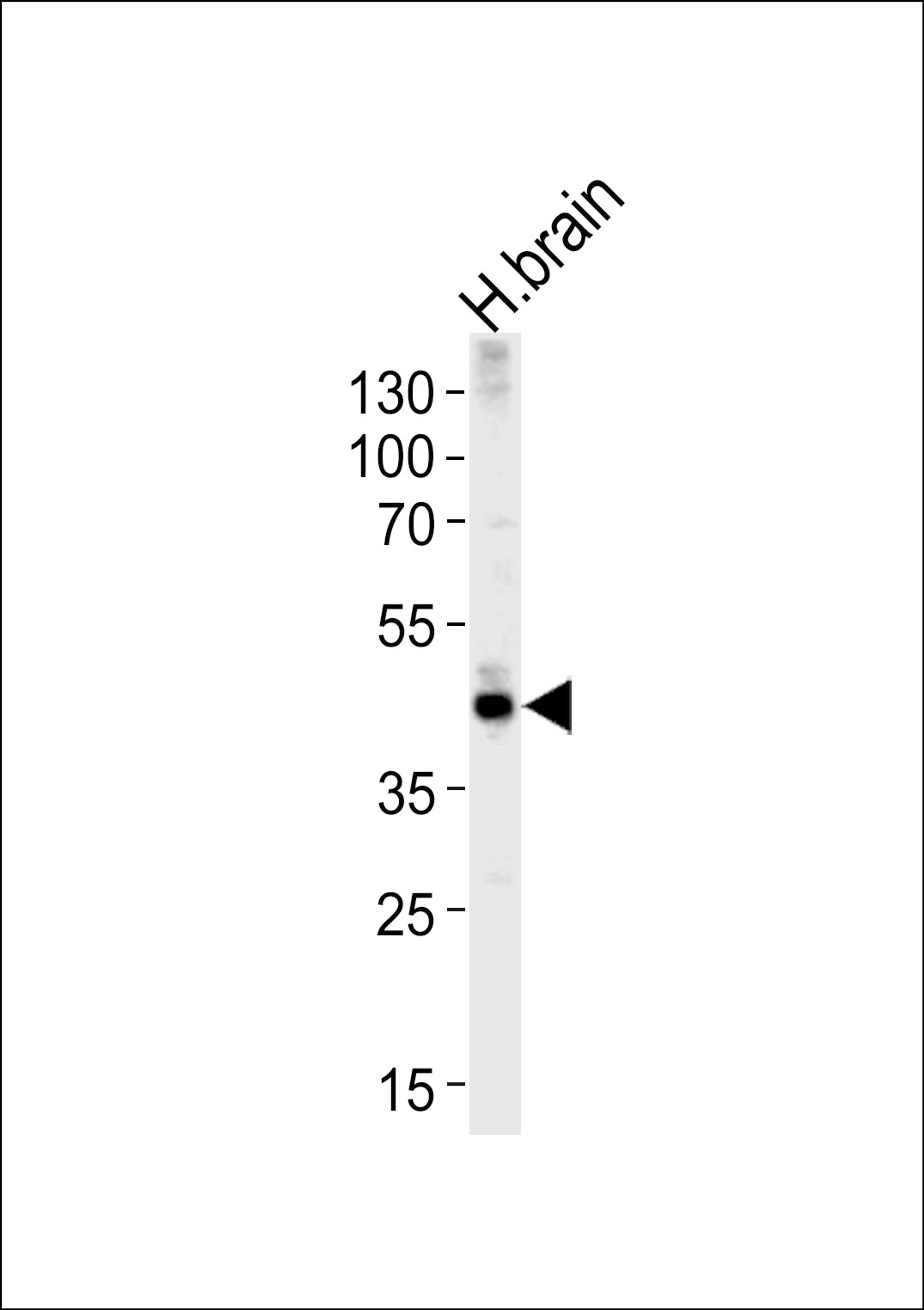 Western blot analysis of lysate from human brain tissue lysate, using ALDOC Antibody at 1:1000 at each lane.