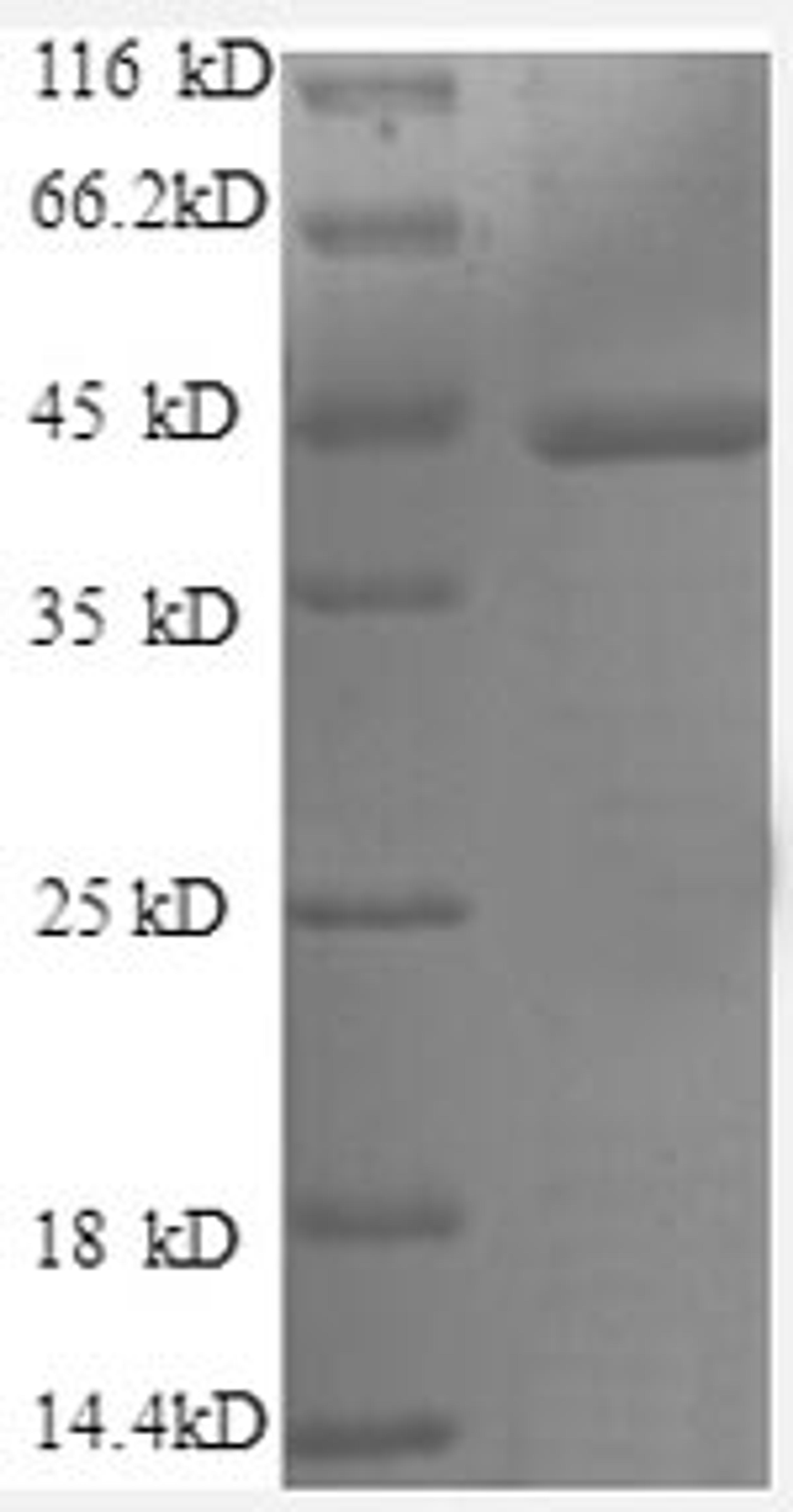(Tris-Glycine gel) Discontinuous SDS-PAGE (reduced) with 5% enrichment gel and 15% separation gel.