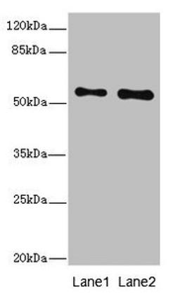 Western blot. All lanes: RPS6KL1 antibody at 4.02ug/ml. Lane 1: Mouse heart tissue. Lane 2: Mouse kidney tissue. Secondary. Goat polyclonal to rabbit IgG at 1/10000 dilution. Predicted band size: 61, 60, 29 kDa. Observed band size: 61 kDa. 