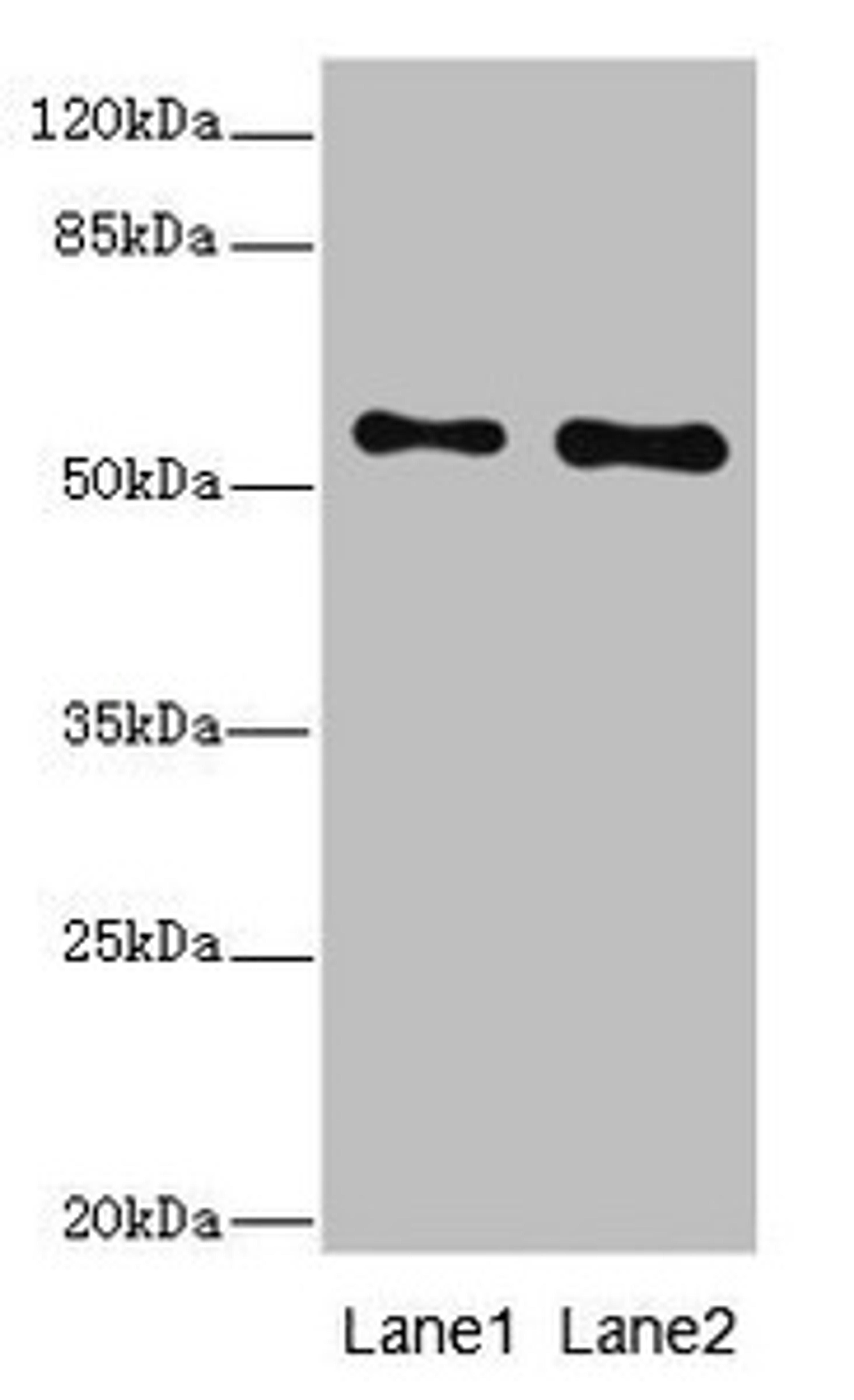 Western blot. All lanes: RPS6KL1 antibody at 4.02ug/ml. Lane 1: Mouse heart tissue. Lane 2: Mouse kidney tissue. Secondary. Goat polyclonal to rabbit IgG at 1/10000 dilution. Predicted band size: 61, 60, 29 kDa. Observed band size: 61 kDa. 