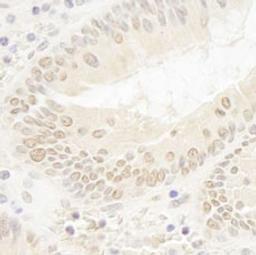 Detection of human DOT1L by immunohistochemistry.