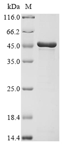 (Tris-Glycine gel) Discontinuous SDS-PAGE (reduced) with 5% enrichment gel and 15% separation gel.