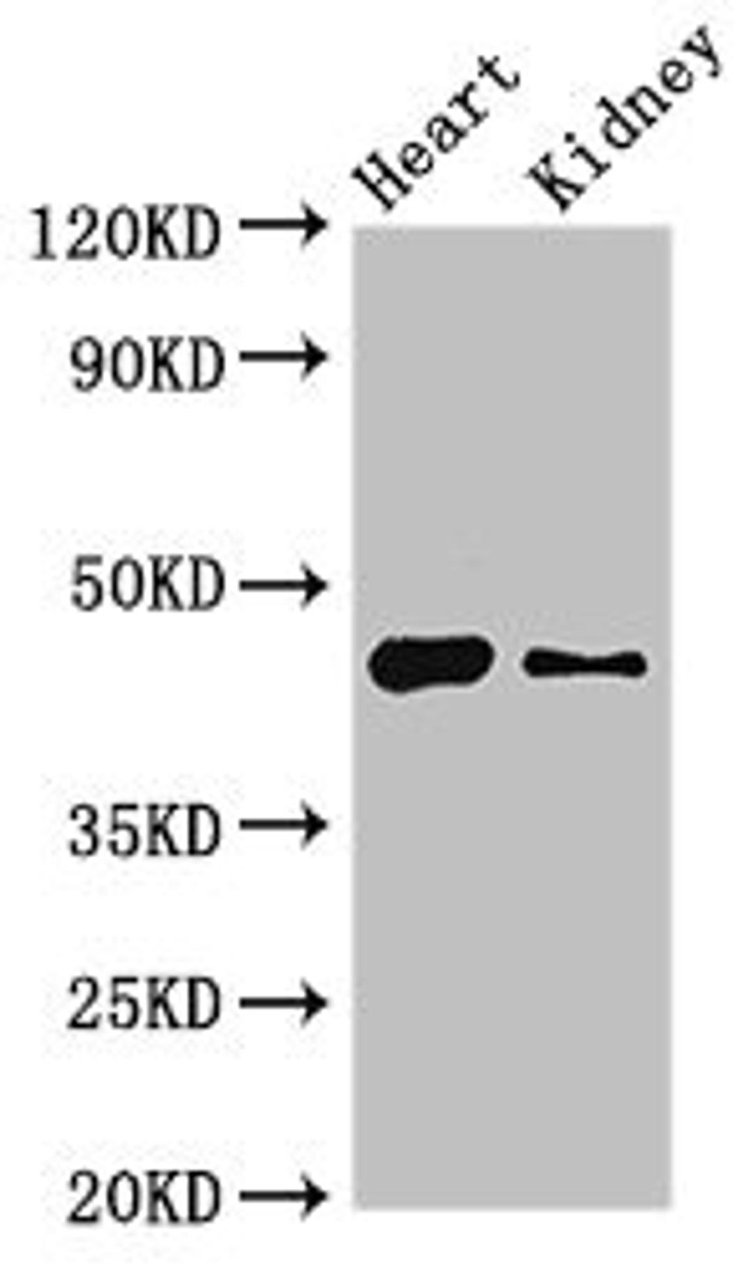 Western Blot. Positive WB detected in: Mouse heart tissue, Mouse kidney tissue. All lanes: MNDA antibody at 4ug/ml. Secondary. Goat polyclonal to rabbit IgG at 1/50000 dilution. Predicted band size: 46 kDa. Observed band size: 46 kDa. 