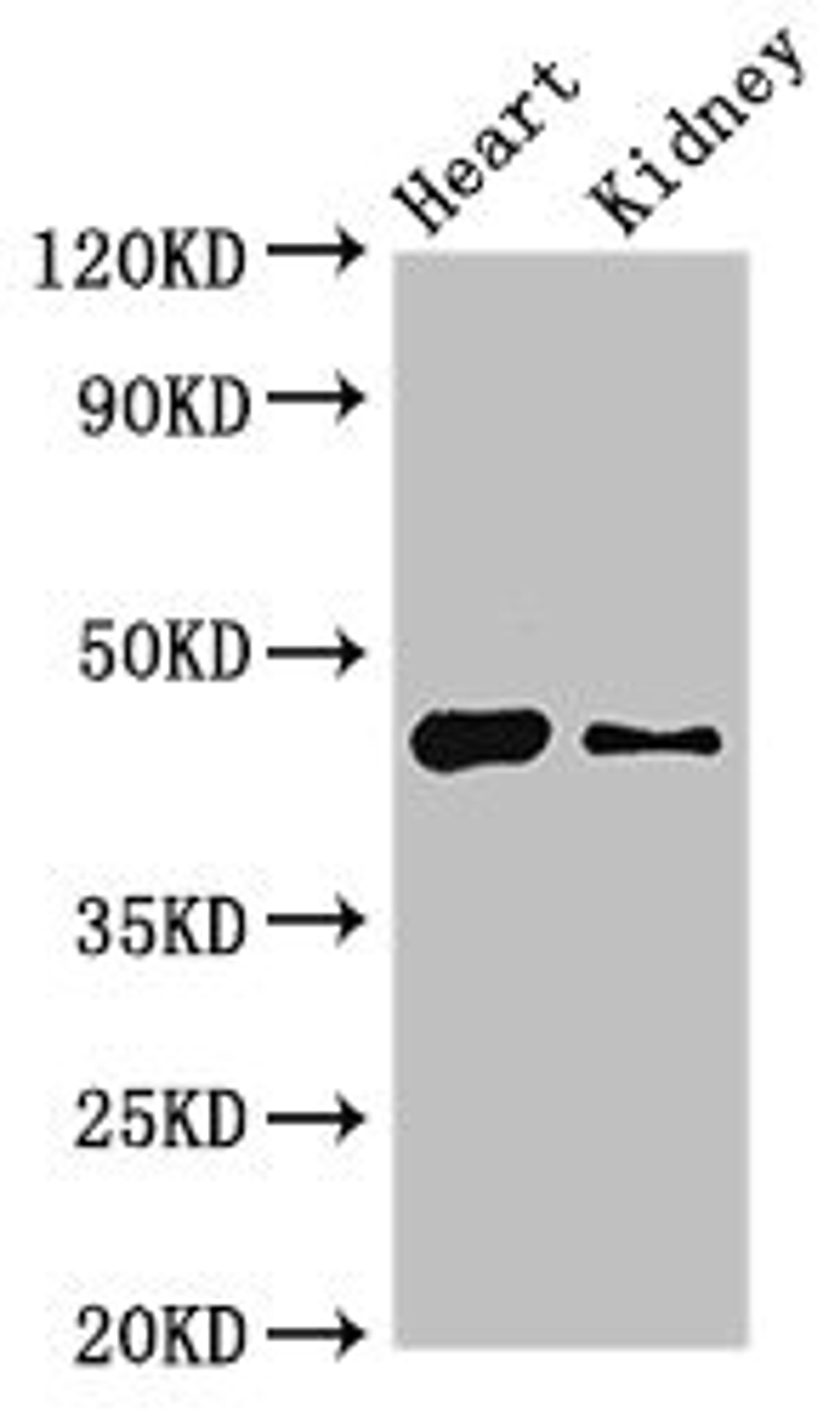 Western Blot. Positive WB detected in: Mouse heart tissue, Mouse kidney tissue. All lanes: MNDA antibody at 4ug/ml. Secondary. Goat polyclonal to rabbit IgG at 1/50000 dilution. Predicted band size: 46 kDa. Observed band size: 46 kDa. 
