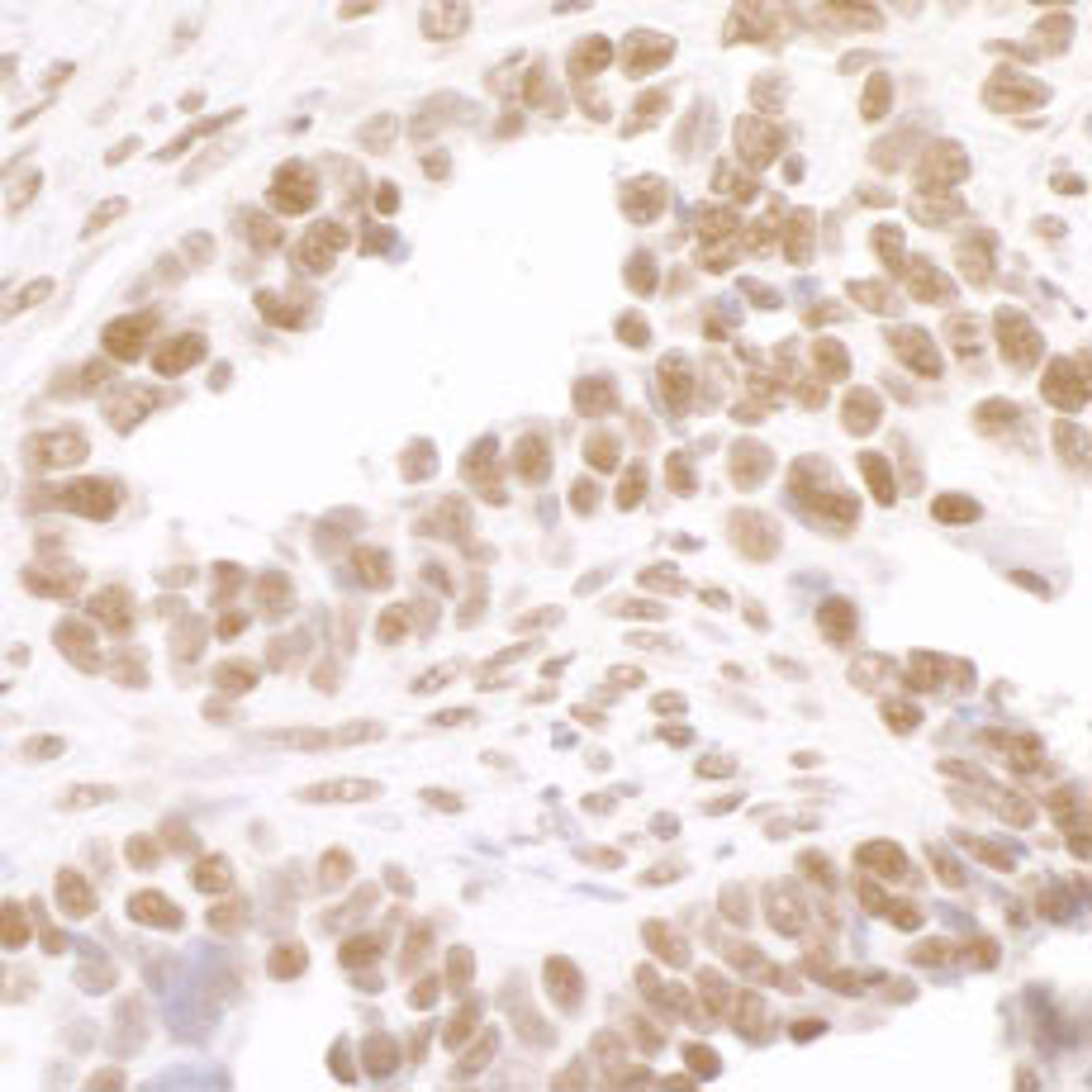 Detection of human Phospho-RNA Polymerase II (S2) by immunohistochemistry.