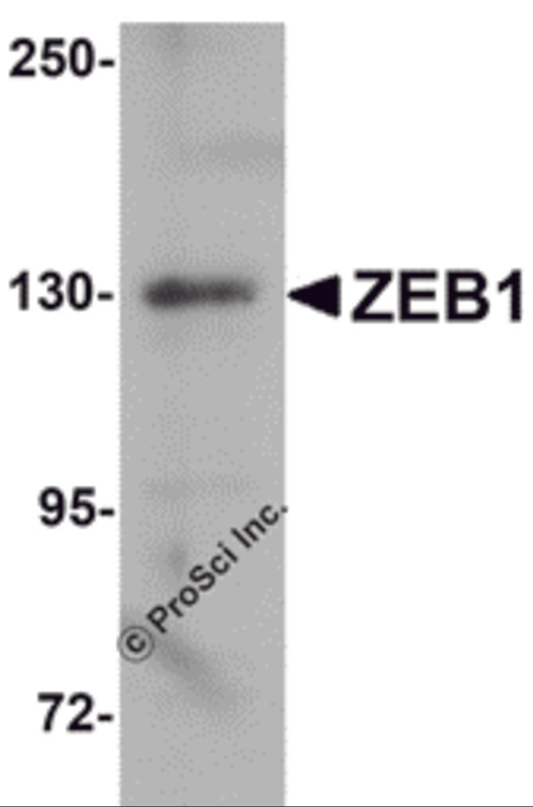 Western blot analysis of ZEB1 in HeLa cell lysate with ZEB1 antibody at 1&#956;g/mL.