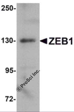 Western blot analysis of ZEB1 in HeLa cell lysate with ZEB1 antibody at 1μg/mL.