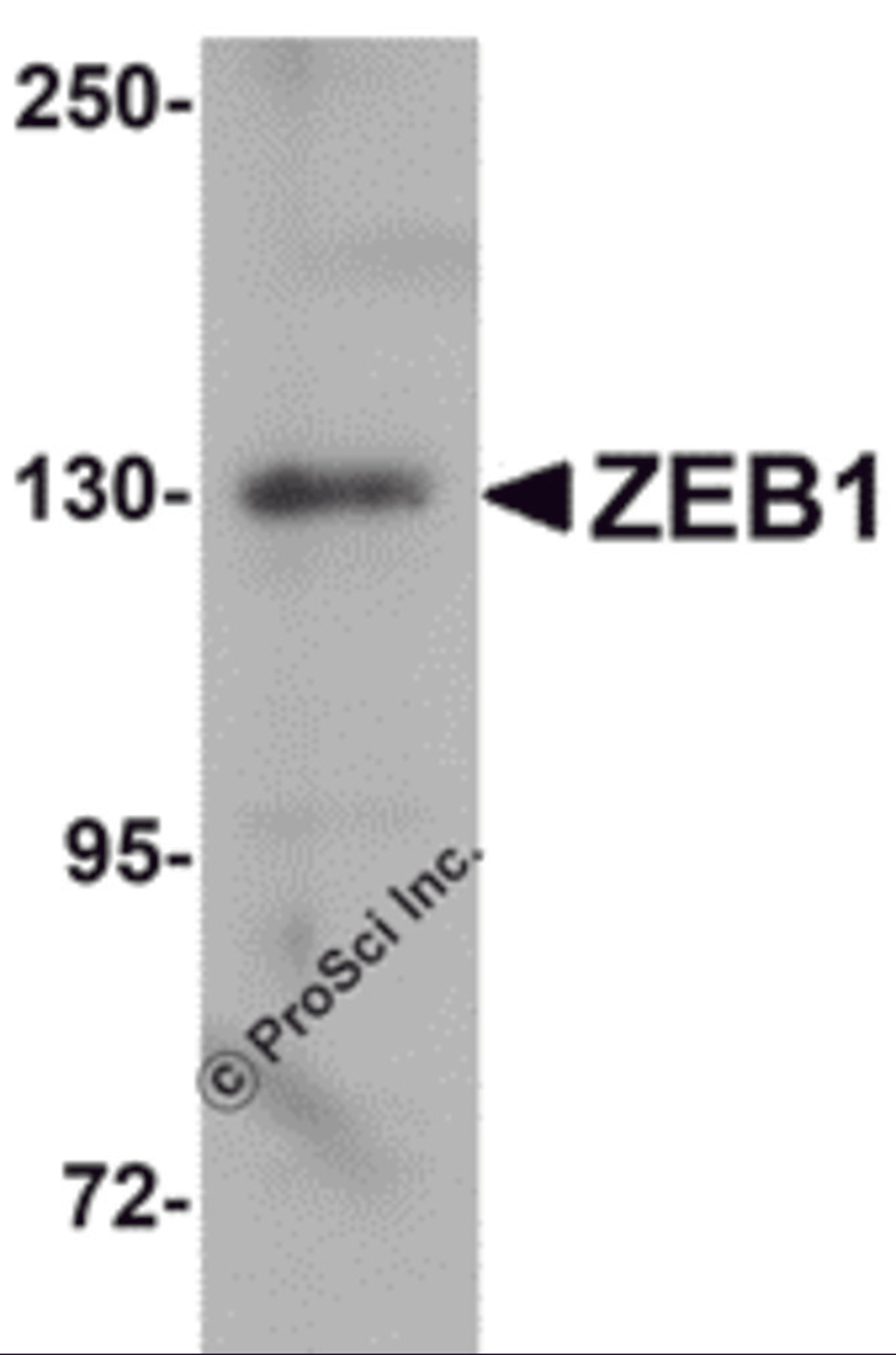 Western blot analysis of ZEB1 in HeLa cell lysate with ZEB1 antibody at 1μg/mL.