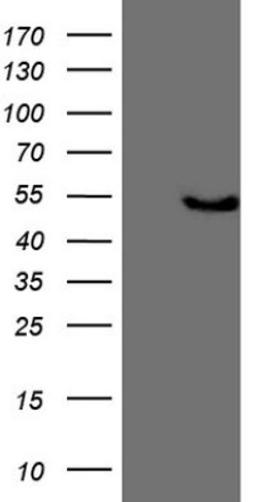 Western Blot: KCTD9 Antibody (2G8) [NBP2-45488] - Analysis of HEK293T cells were transfected with the pCMV6-ENTRY control (Left lane) or pCMV6-ENTRY KCTD9.