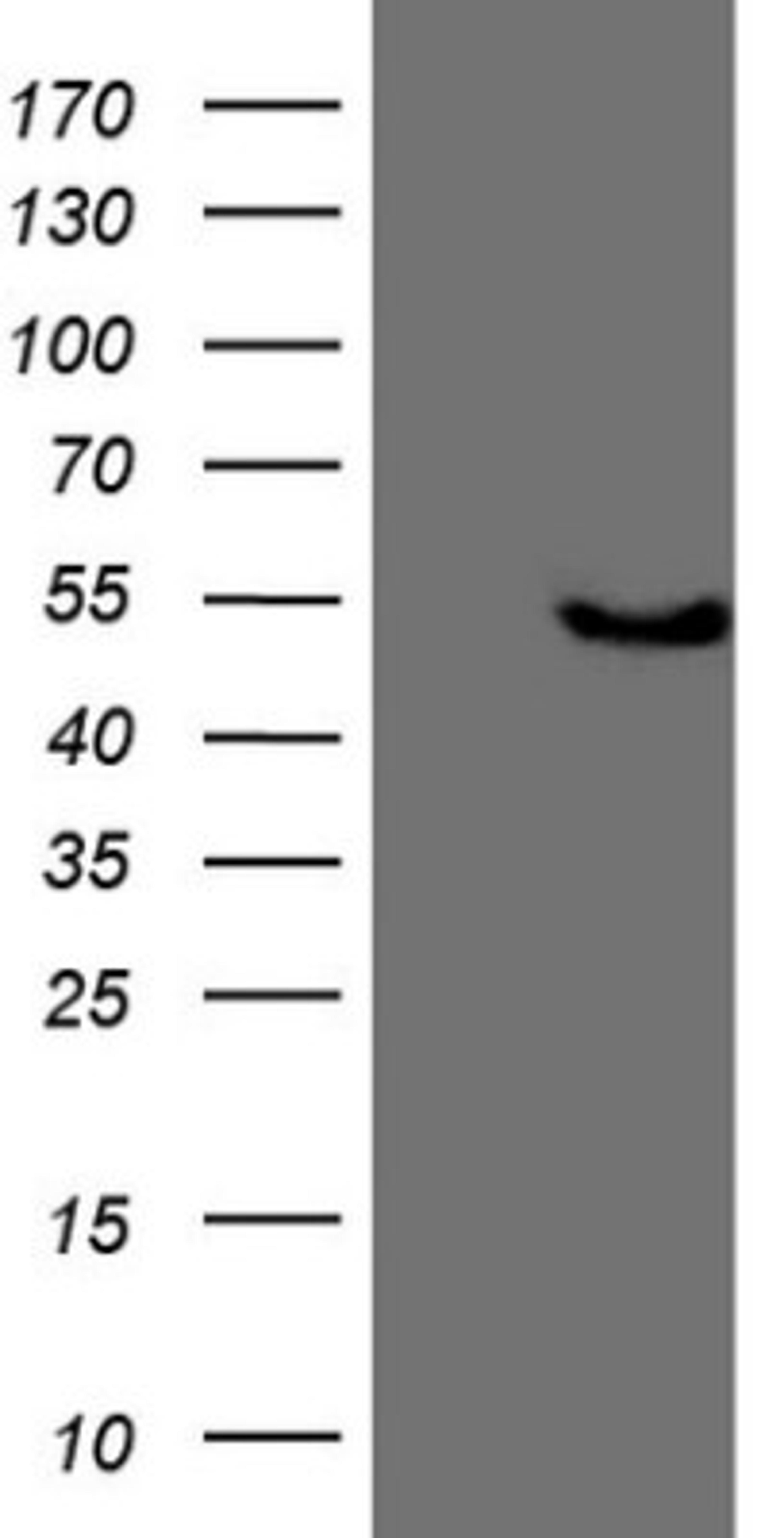 Western Blot: KCTD9 Antibody (2G8) [NBP2-45488] - Analysis of HEK293T cells were transfected with the pCMV6-ENTRY control (Left lane) or pCMV6-ENTRY KCTD9.