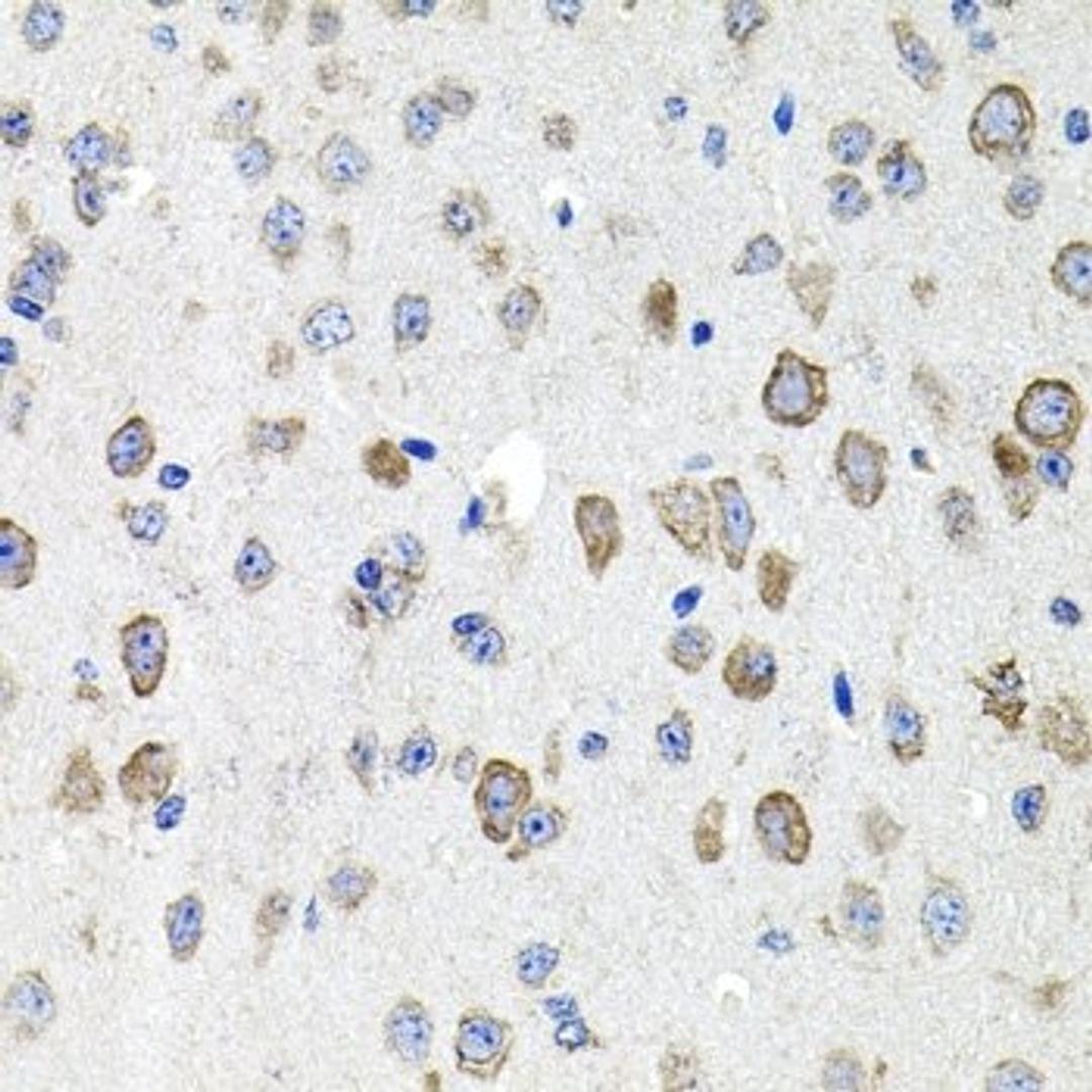 Immunohistochemistry of paraffin-embedded mouse brain using CDH23 antibody