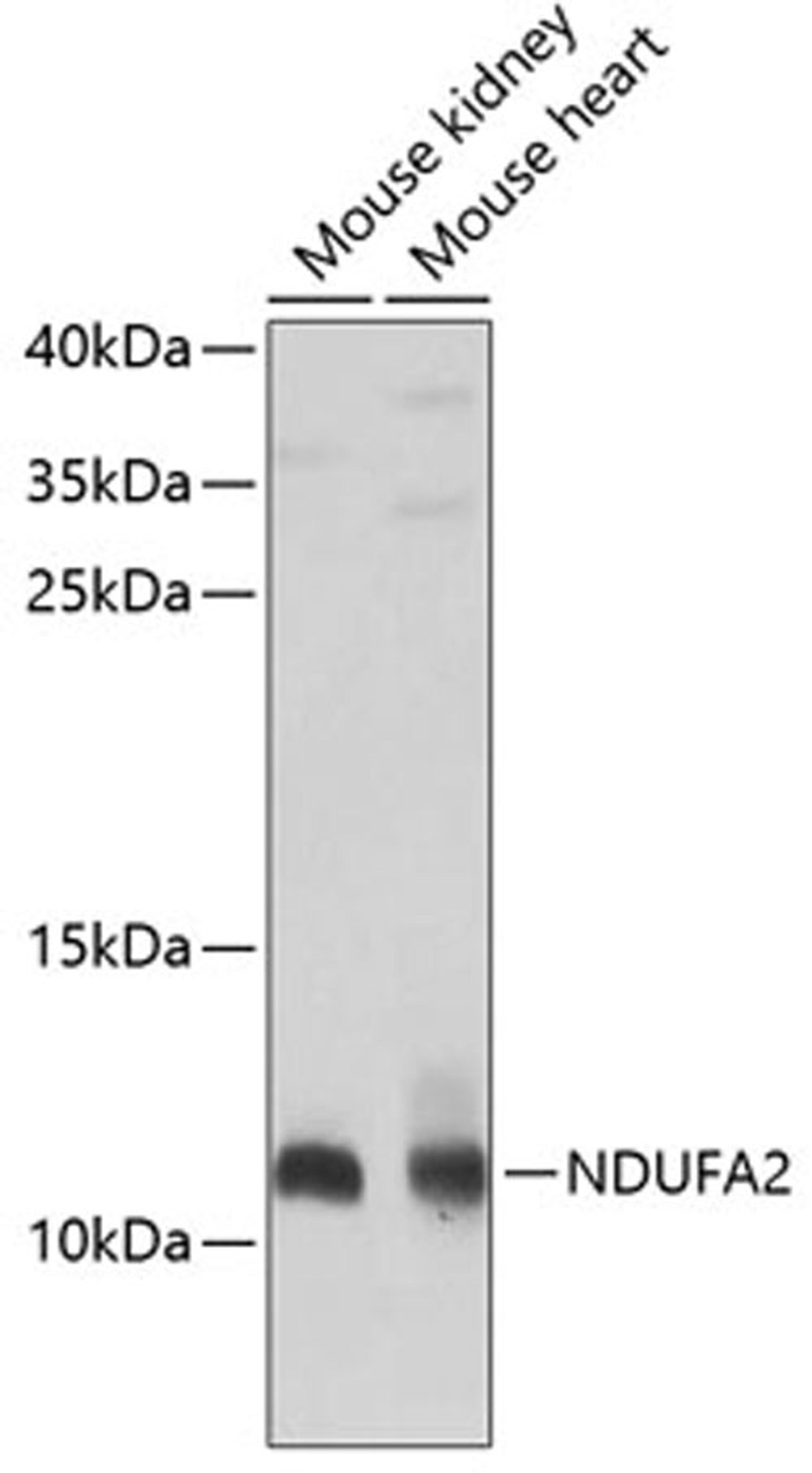 Western blot - NDUFA2 antibody (A8136)