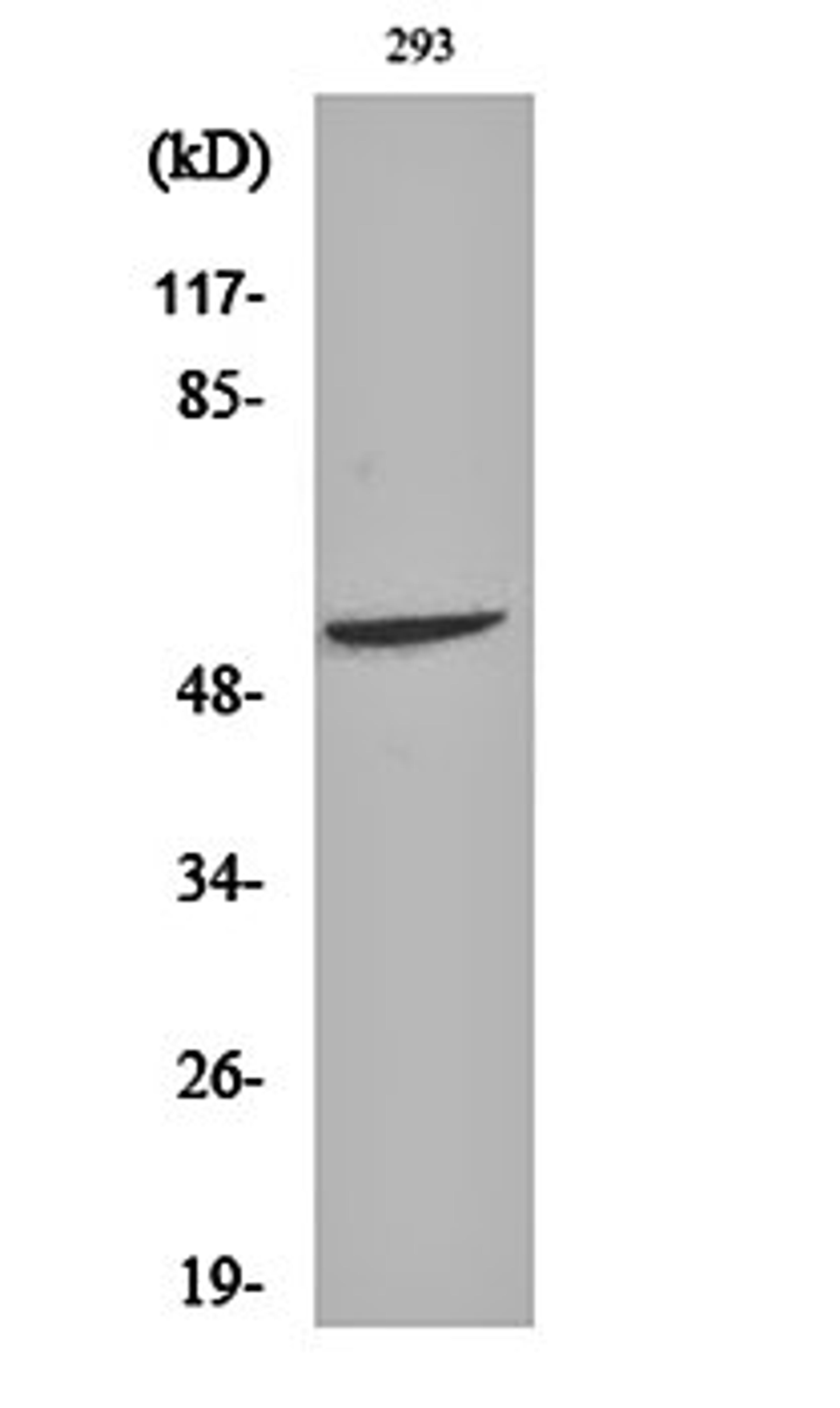 Western blot analysis of 293 cell lysates using Fgl2 antibody