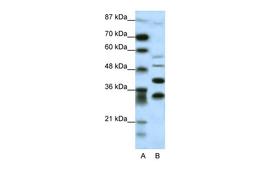 Antibody used in WB on Human HepG2 at 0.2-1 ug/ml.