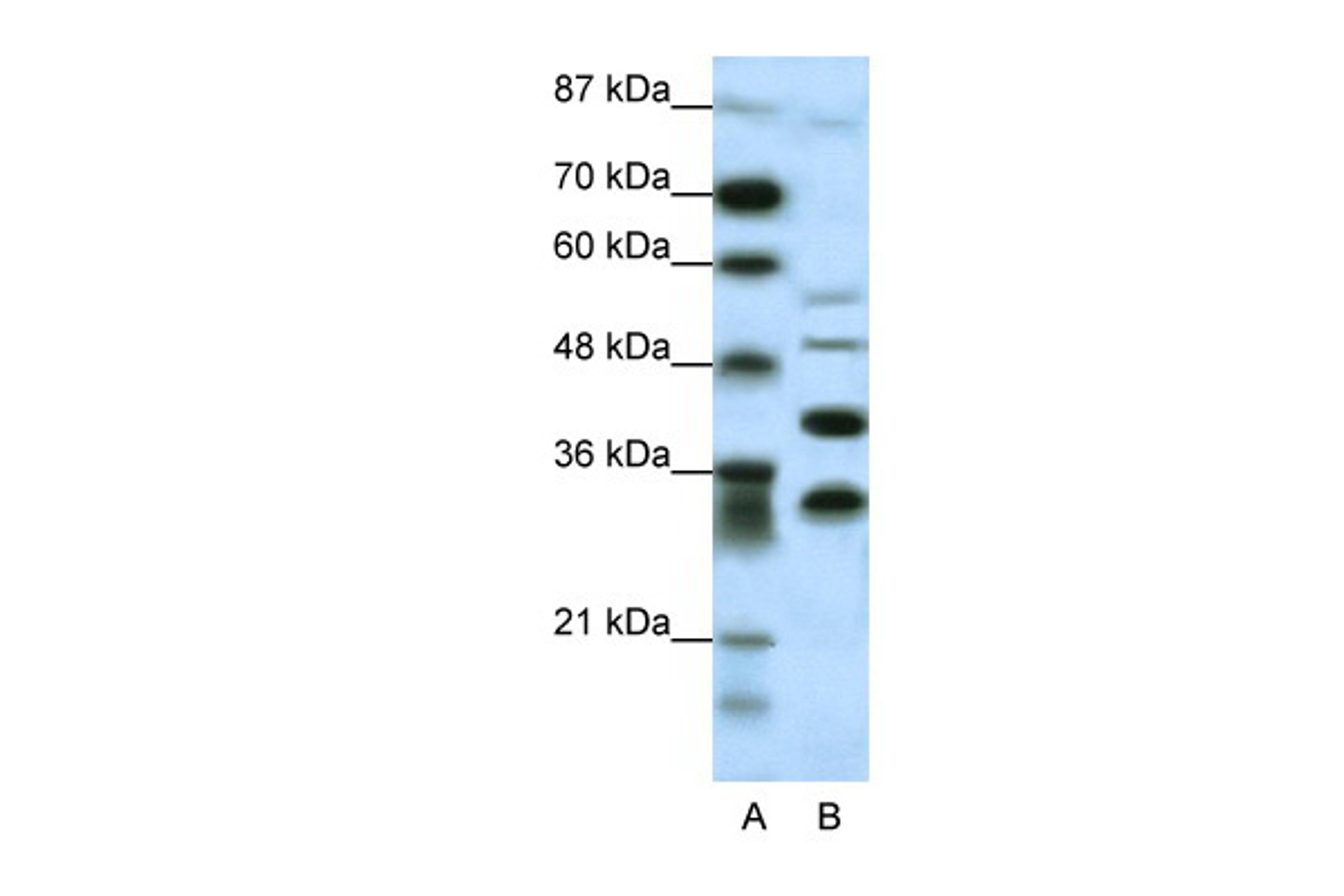 Antibody used in WB on Human HepG2 at 0.2-1 ug/ml.