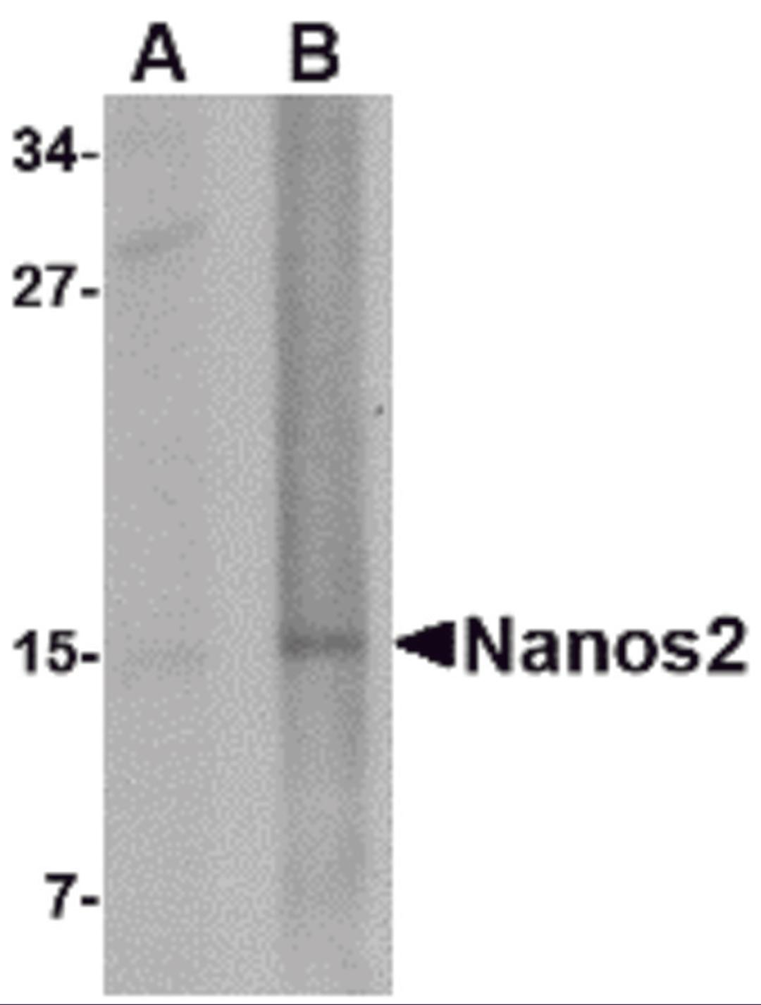 Western blot analysis of Nanos2 in rat brain tissue lysate with Nanos2 antibody at (A) 1 and (B) 2 &#956;g/mL.