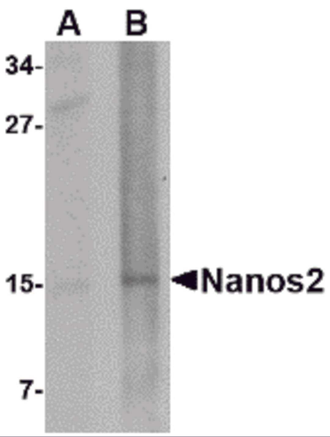 Western blot analysis of Nanos2 in rat brain tissue lysate with Nanos2 antibody at (A) 1 and (B) 2 μg/mL.