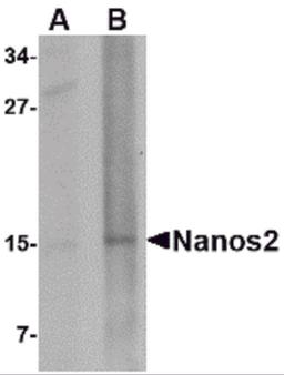 Western blot analysis of Nanos2 in rat brain tissue lysate with Nanos2 antibody at (A) 1 and (B) 2 μg/mL.