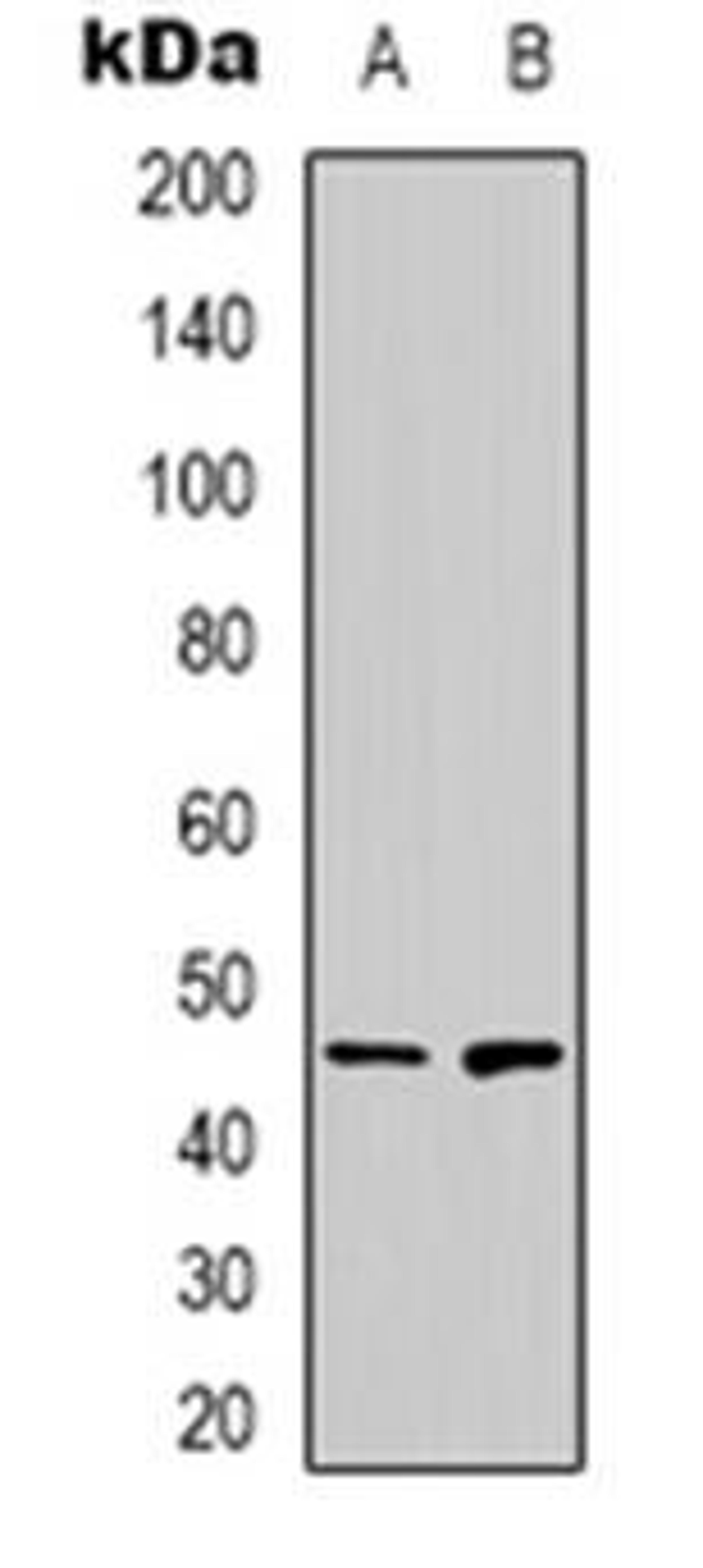 Western blot analysis of ZNF785 expression in A549 (Lane 1), Hela (Lane 2) whole cell lysates using ZNF785 antibody