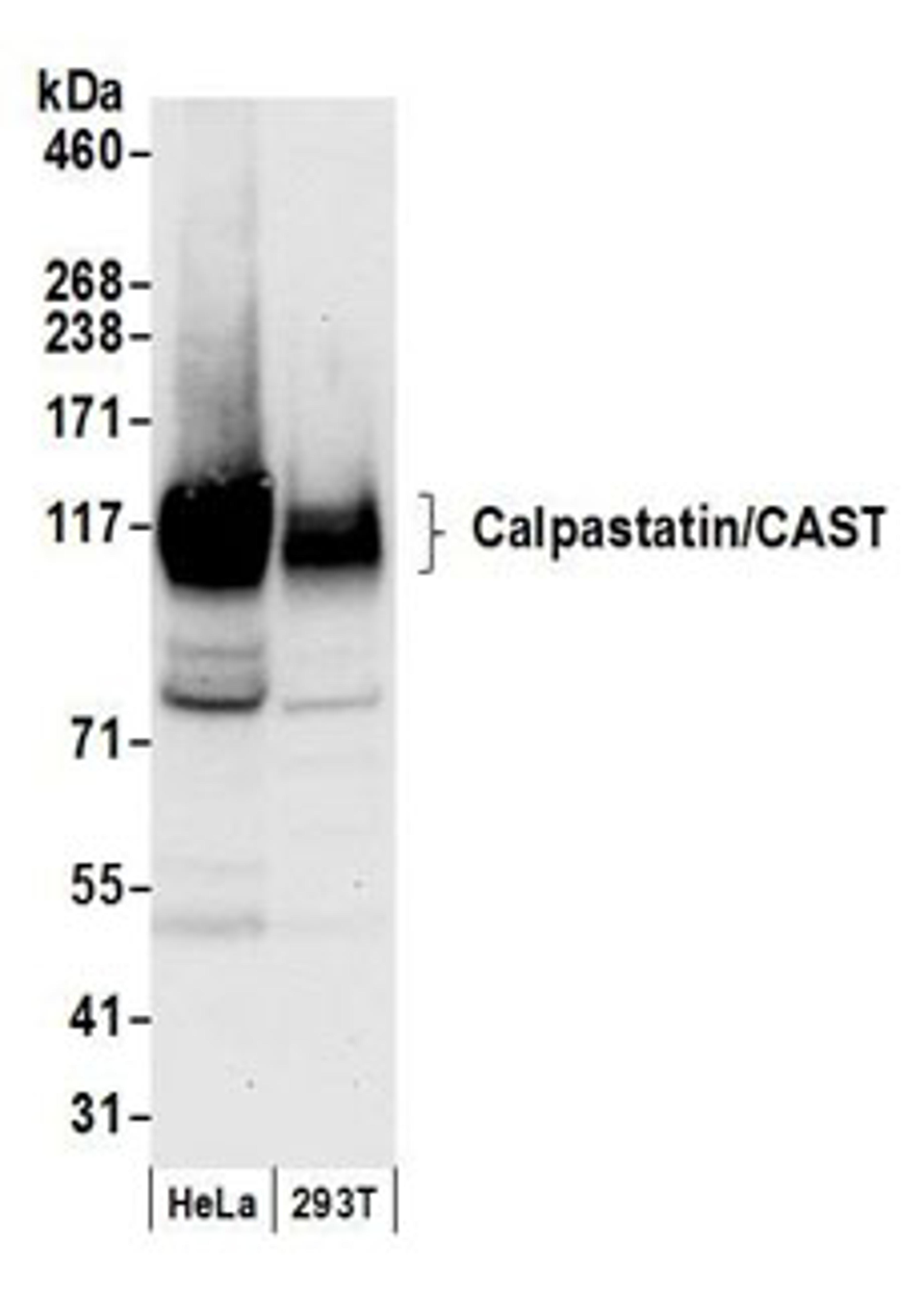 Detection of human Calpastatin/CAST by western blot.