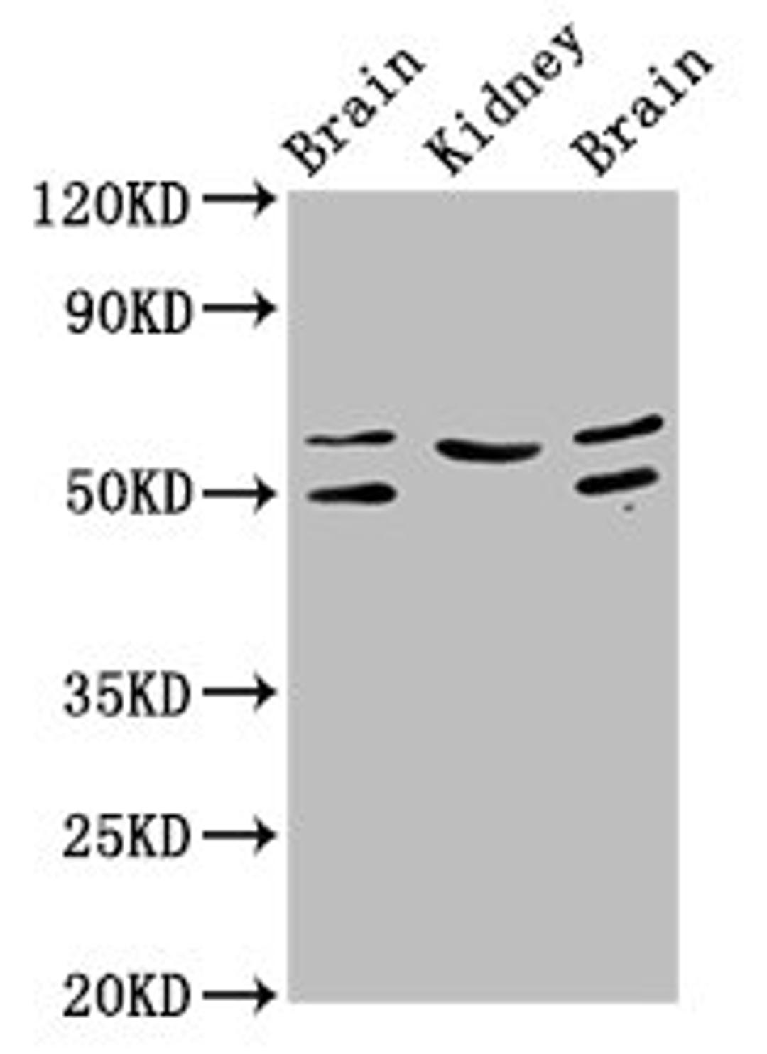 Western Blot. Positive WB detected in: Rat brain tissue, Rat kidney tissue, Mouse brain tissue. All lanes: ANGPT2 antibody at 3.2µg/ml. Secondary. Goat polyclonal to rabbit IgG at 1/50000 dilution. Predicted band size: 57, 51 kDa. Observed band size: 57, 51 kDa