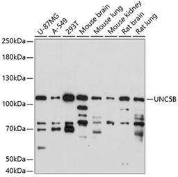 Western blot - UNC5B antibody (A14978)