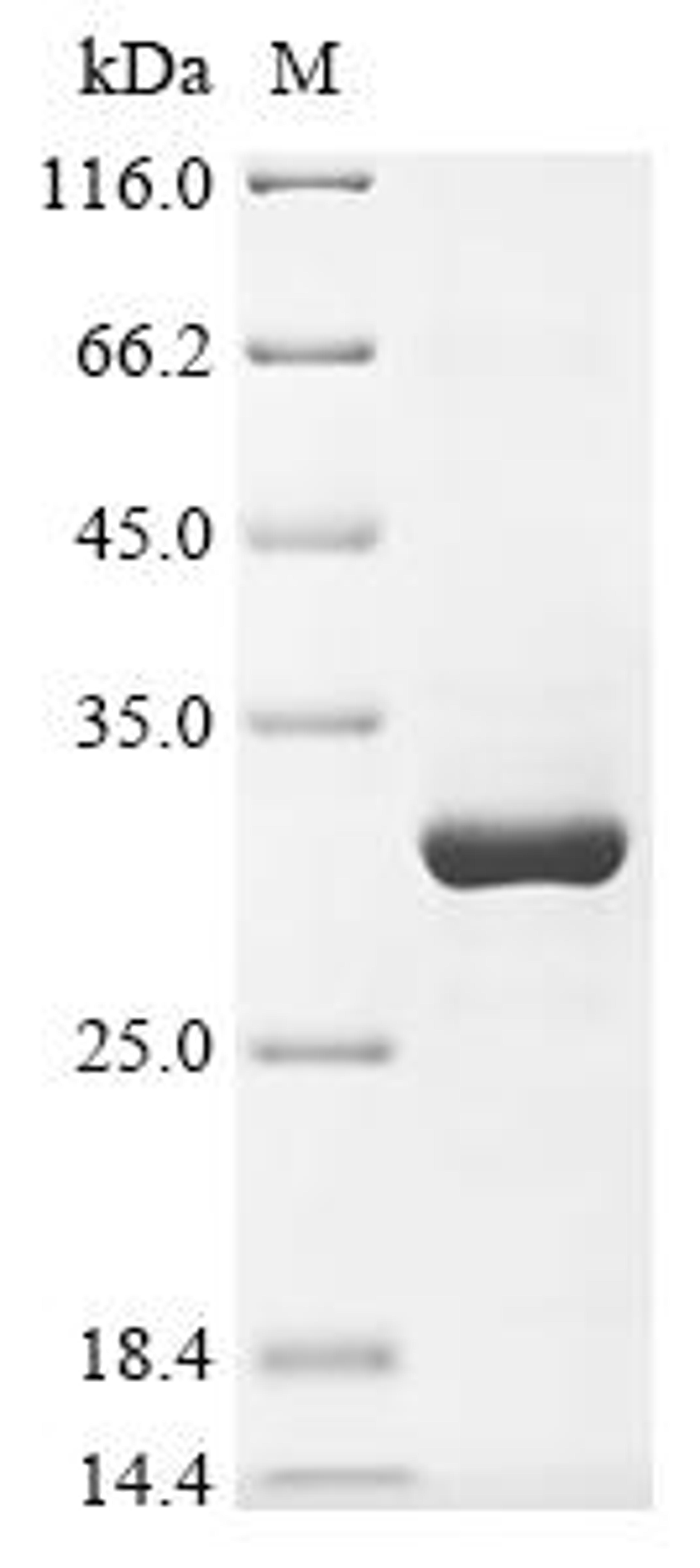 (Tris-Glycine gel) Discontinuous SDS-PAGE (reduced) with 5% enrichment gel and 15% separation gel.