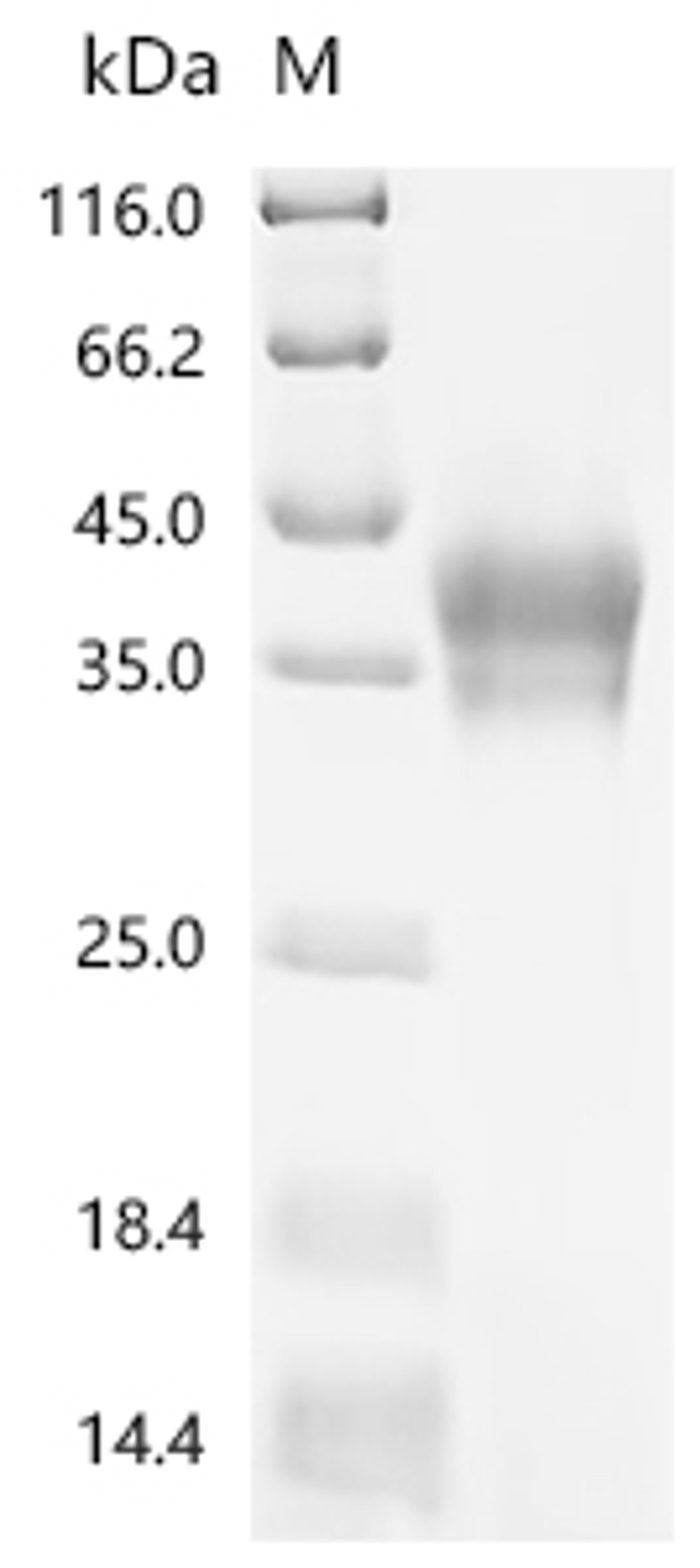 (Tris-Glycine gel) Discontinuous SDS-PAGE (reduced) with 5% enrichment gel and 15% separation gel.