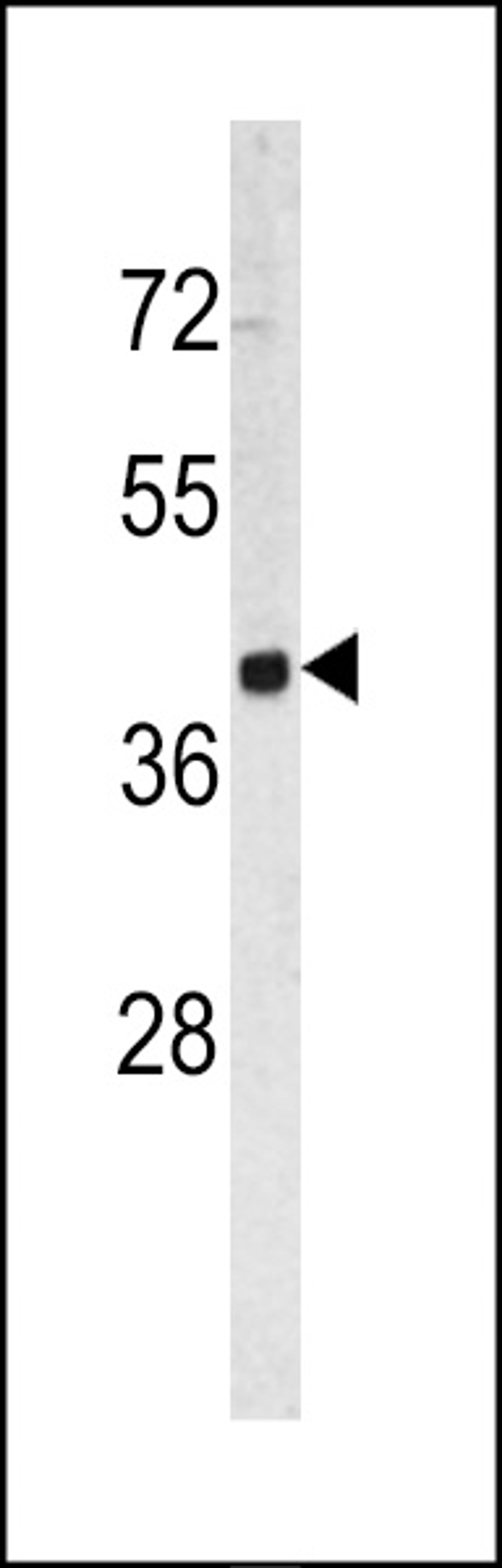 Western blot analysis of TROP2 antibody in HL60 cell line lysates (35ug/lane)