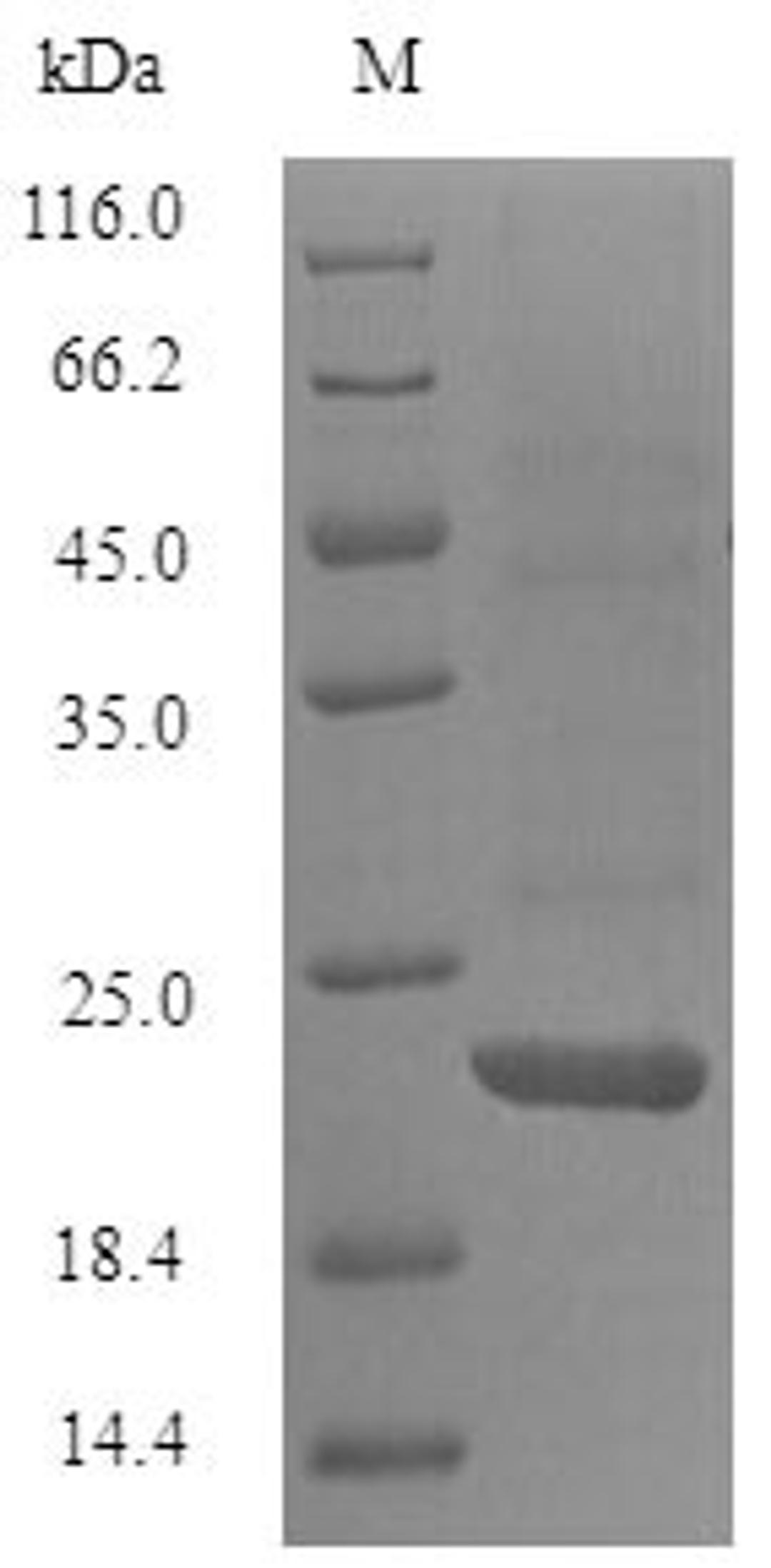 (Tris-Glycine gel) Discontinuous SDS-PAGE (reduced) with 5% enrichment gel and 15% separation gel.