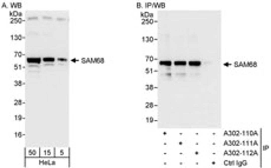 Detection of human SAM68 by western blot and immunoprecipitation.