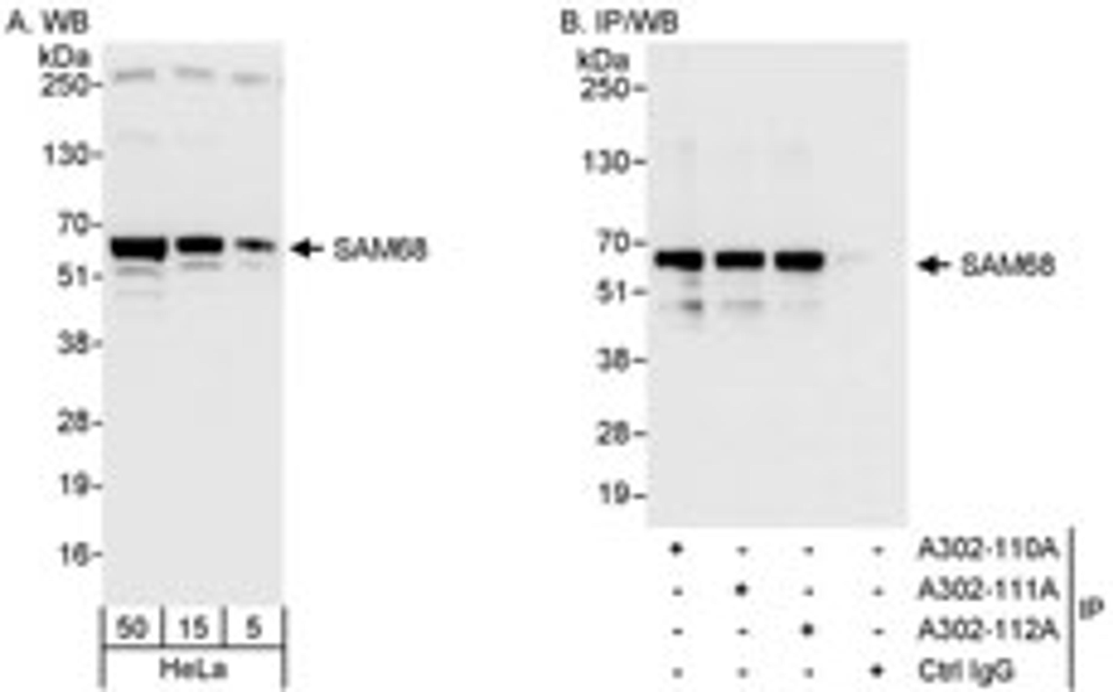 Detection of human SAM68 by western blot and immunoprecipitation.