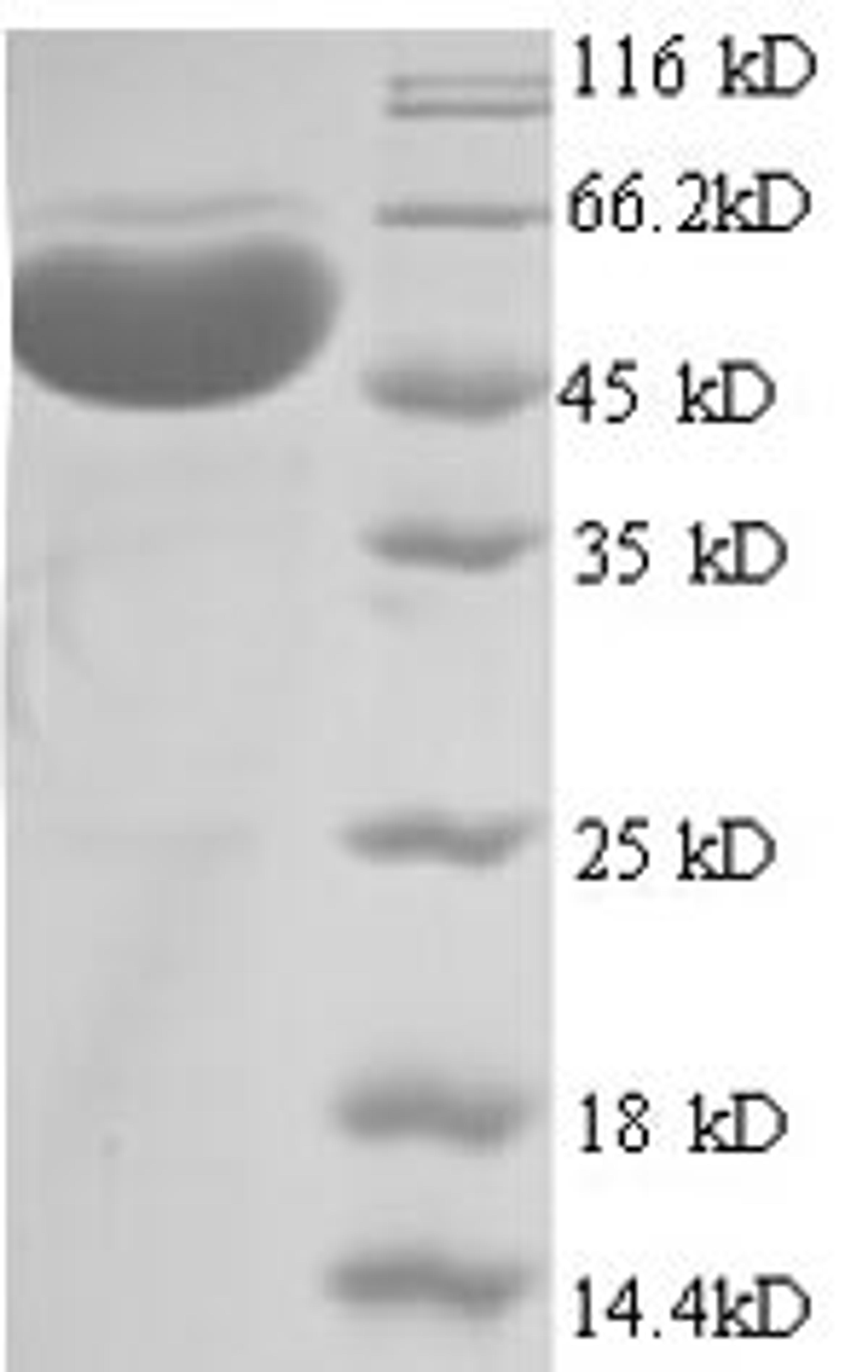 (Tris-Glycine gel) Discontinuous SDS-PAGE (reduced) with 5% enrichment gel and 15% separation gel.
